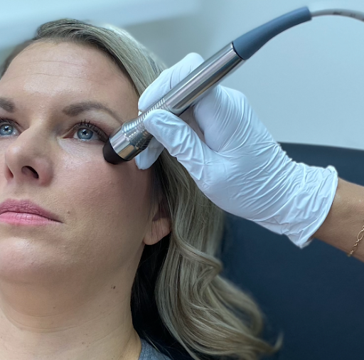 What to Expect During Your Forma I Radiofrequency (RF) Treatment for Dry Eye in Santa Monica