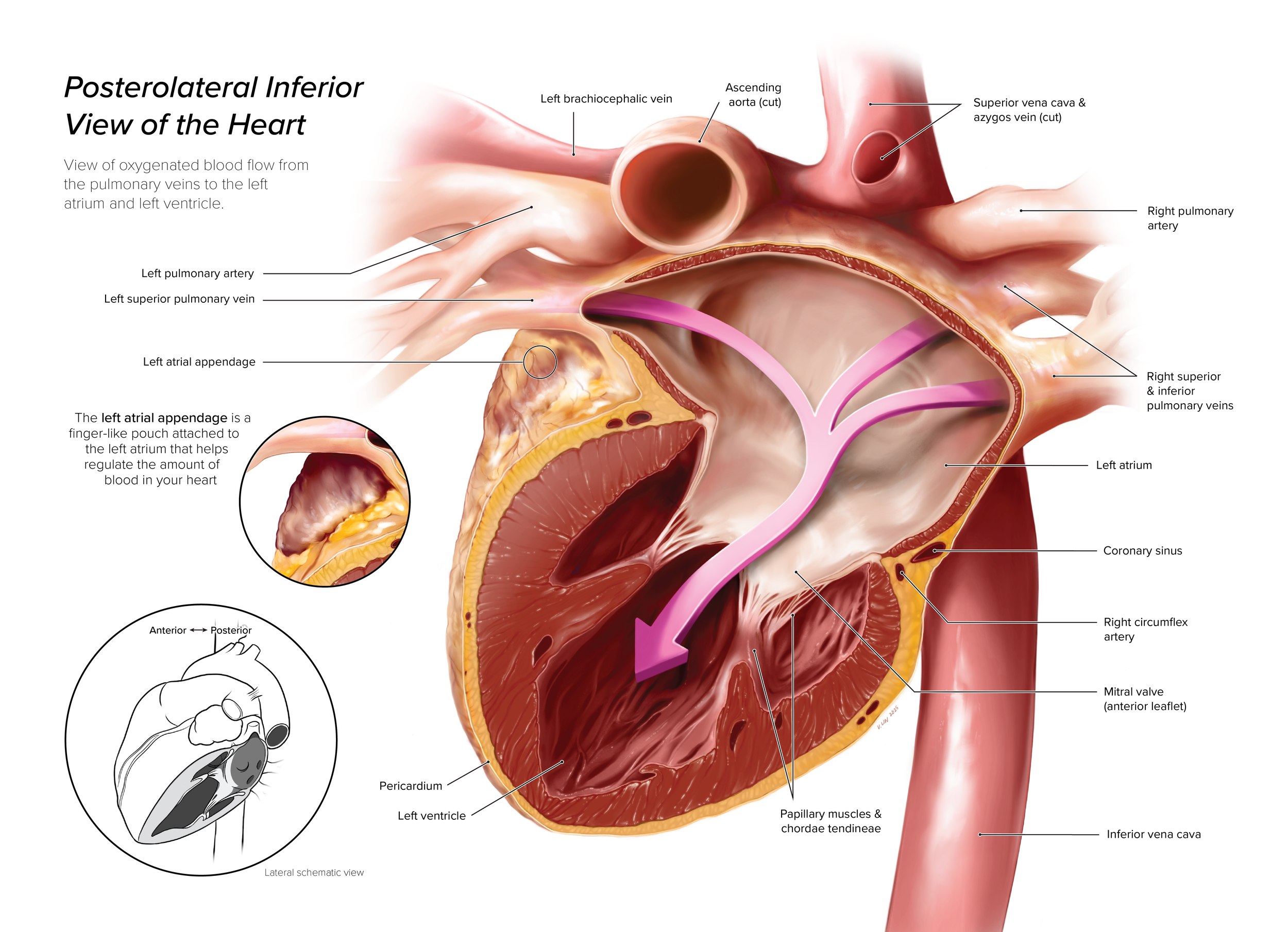 Posterolateral Inferior View of the Heart