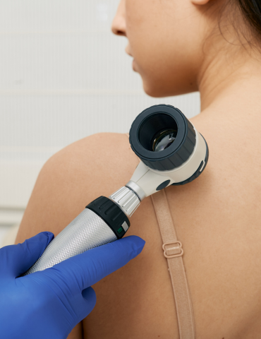 A healthcare professional examines a woman's shoulder with a dermoscope, wearing blue medical gloves, in a clinical setting.