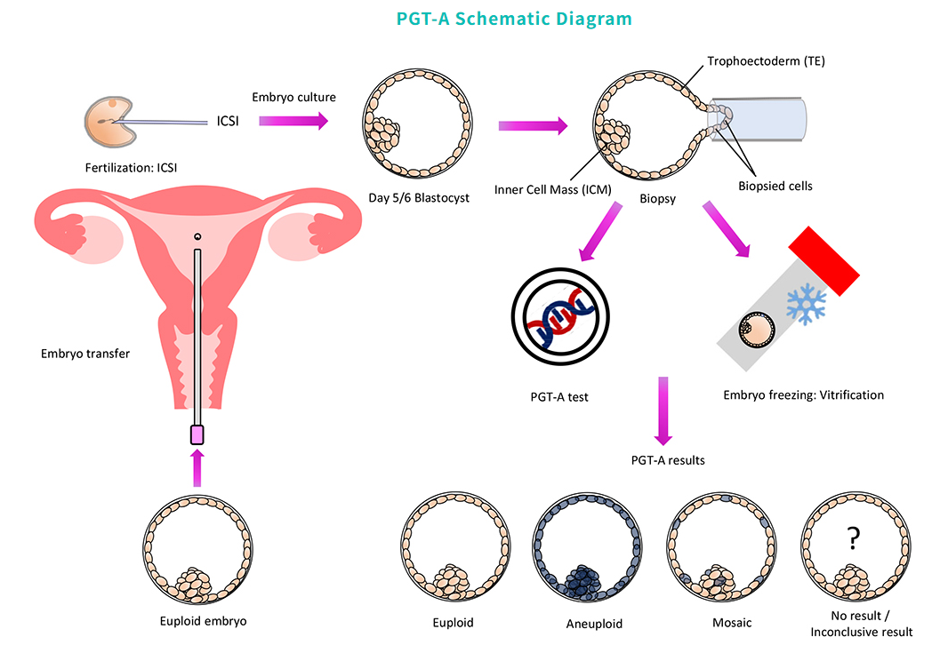 Demand for PGT-A (Third-Gen IVF) Surges 22% in China Amid Demographic Changes