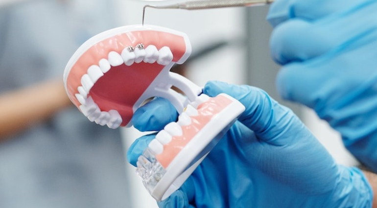 Navigating Expat Dental Care in South China