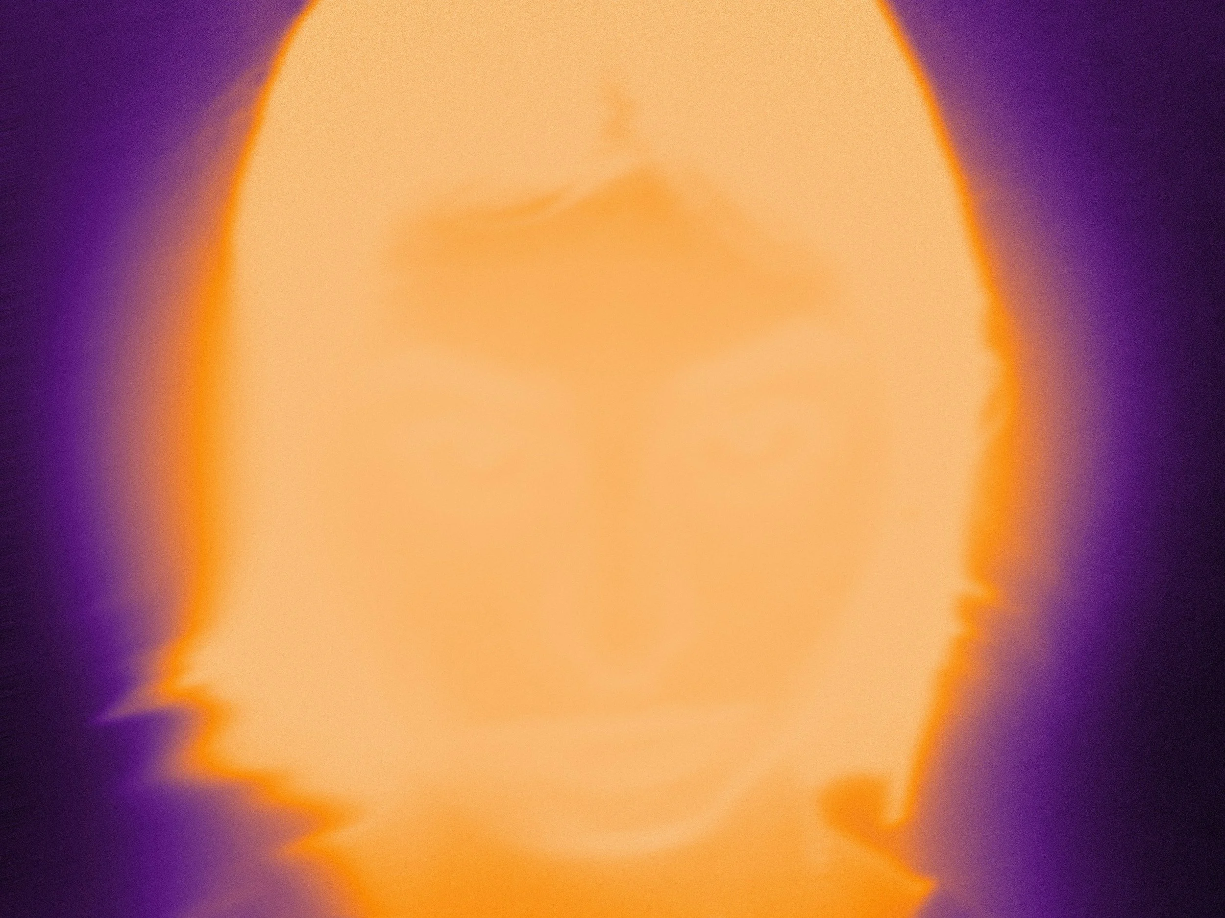 EMDR Is Not What You Think It Is