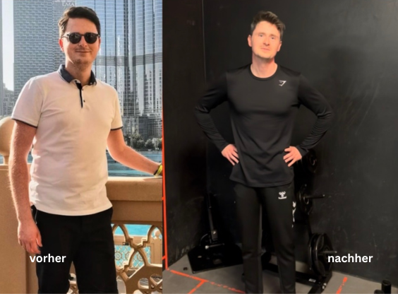 Vorher-Nachher-Vergleich Thomas
