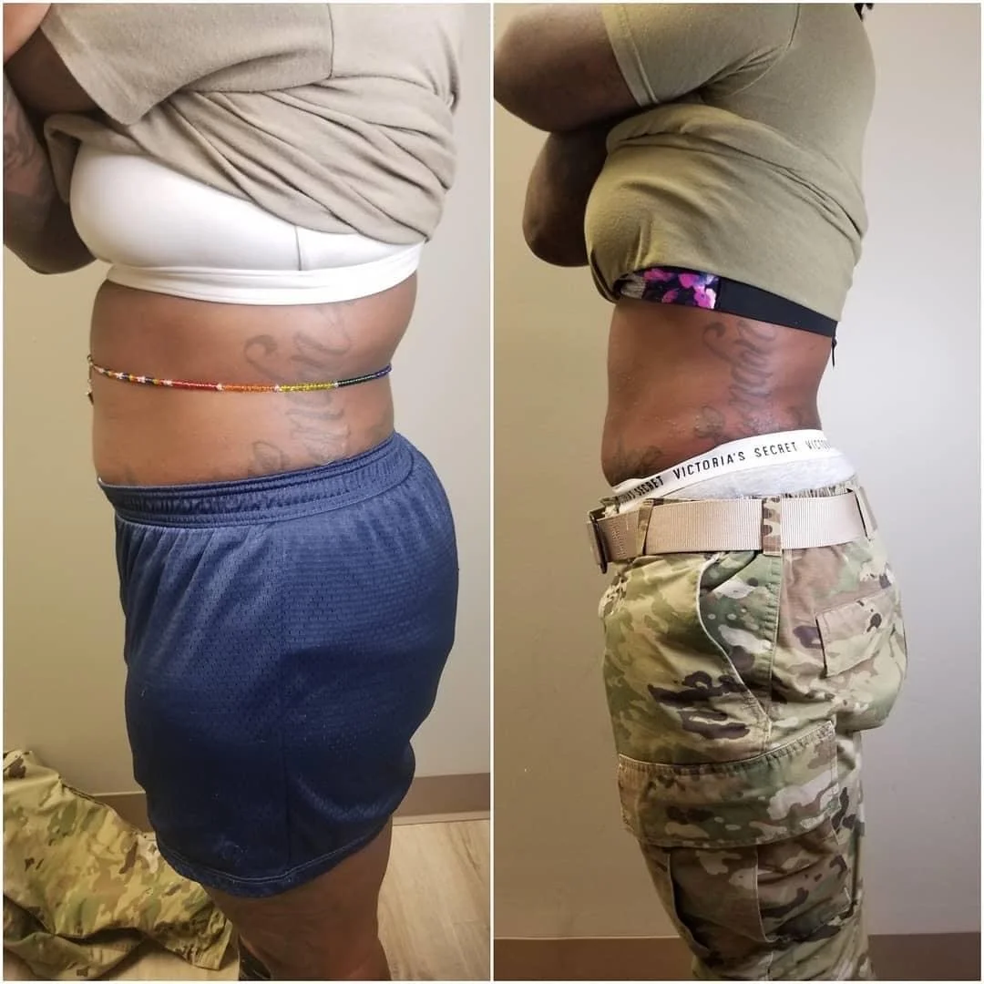 Body Contouring Isn’t a Machine — It’s a Method