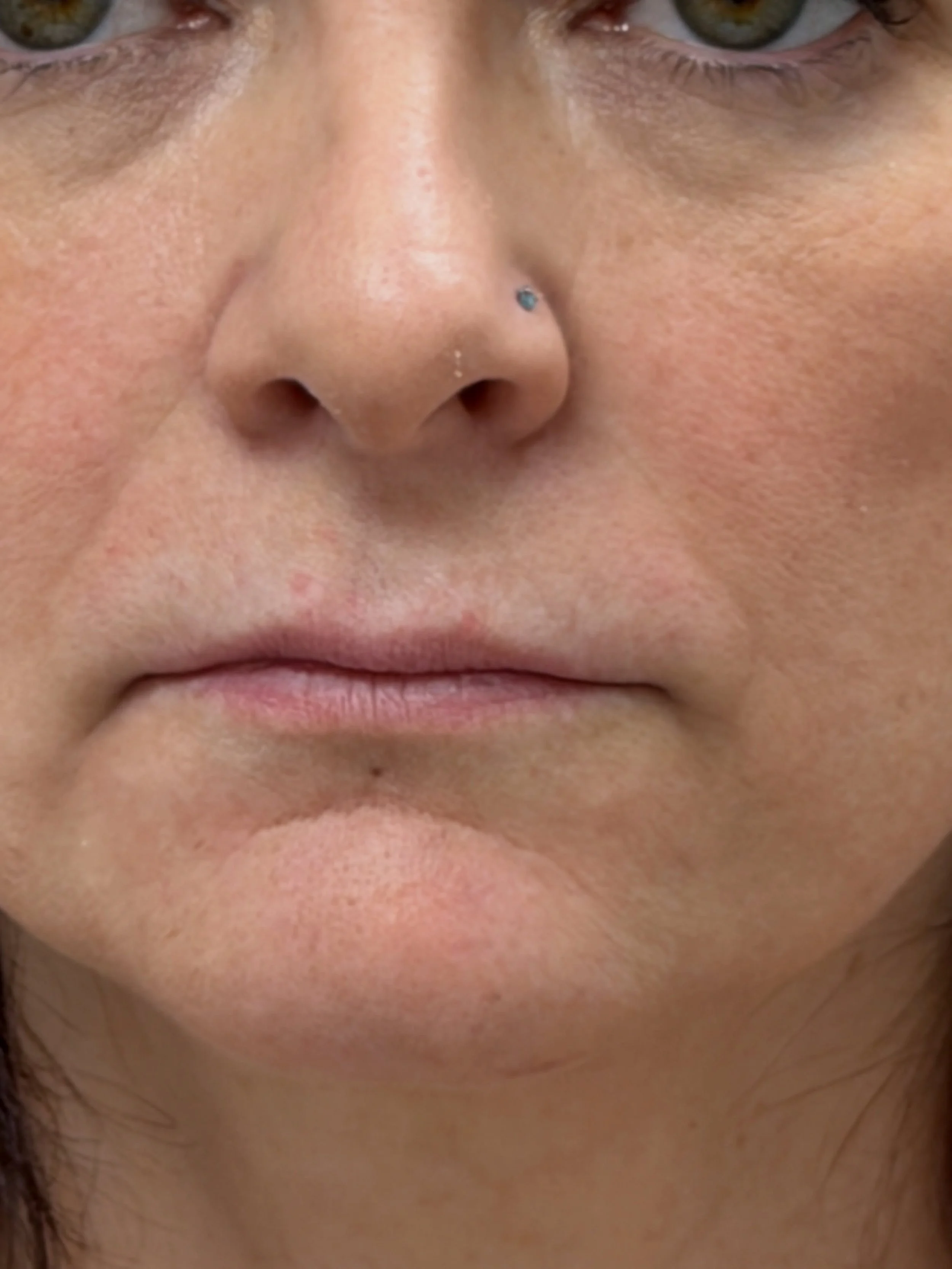 &ldquo;Mini plump&rdquo; Subtle enhancement, stunning difference ✨ Soft, hydrated, beautifully balanced lips&mdash;while still looking completely natural. 💋
