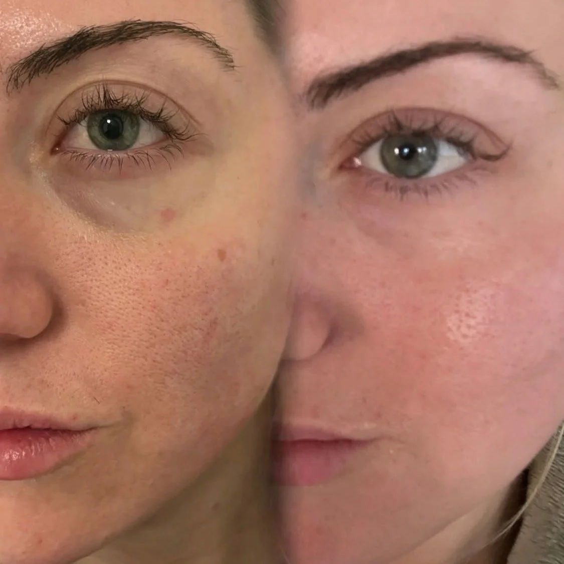 We're thrilled to announce the launch of our new natural hair loss and undereye treatments, along with flexible scheduling and $149 and $249 membership options. These innovations reflect our commitment to providing exceptional care and convenience fo