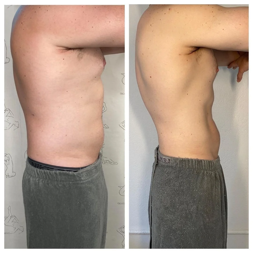 Side-by-side comparison of a man's torso before and after weight loss or fitness training, showing reduction in abdominal size and increased muscle definition.