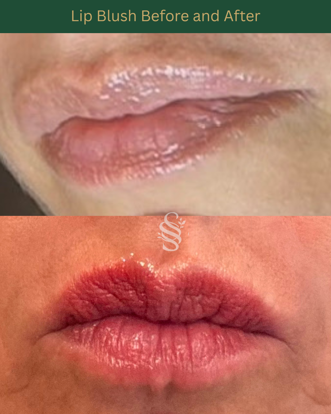 Beige Minimalist Beauty Before After Collage Instagram Post.png