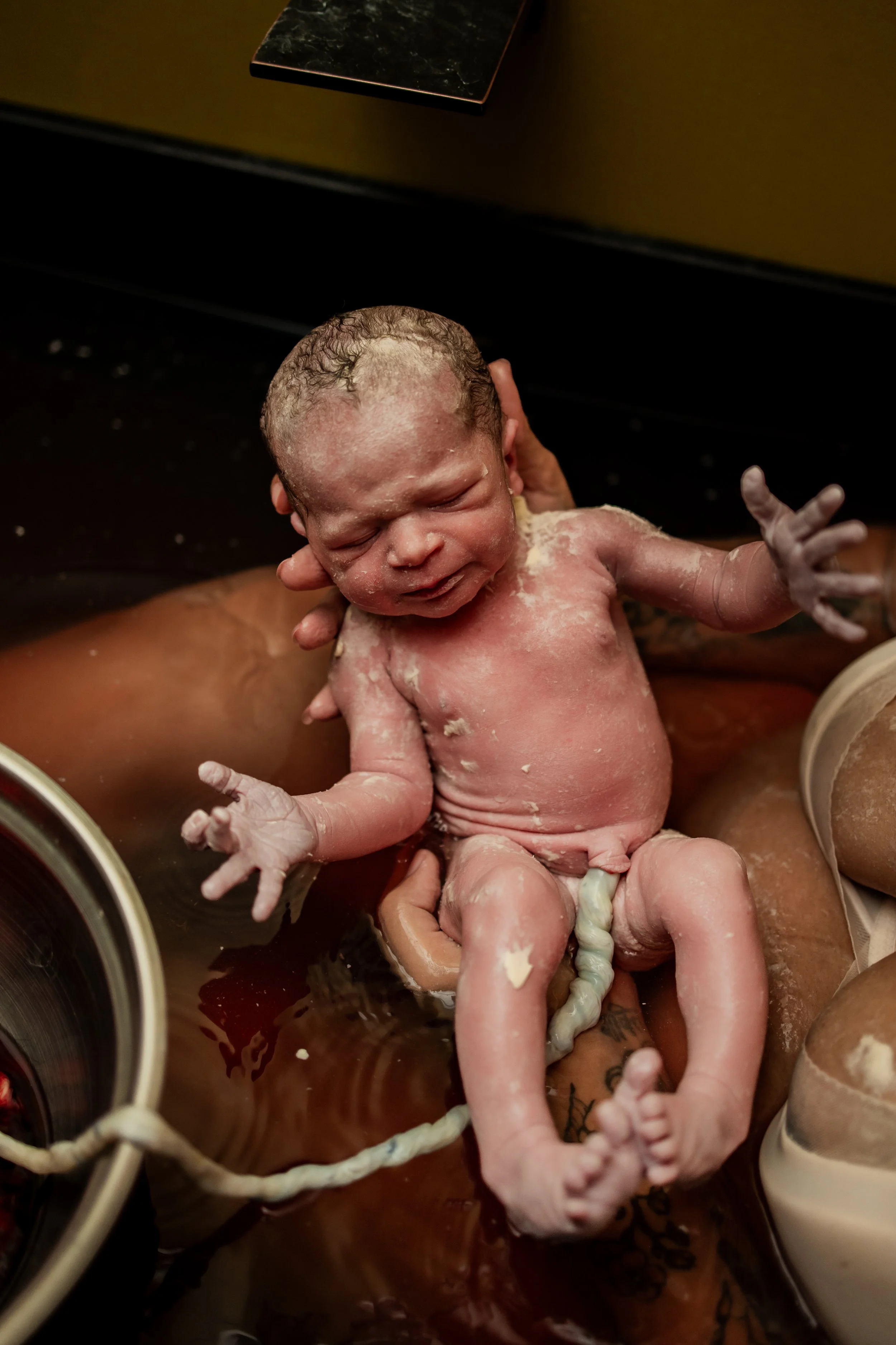 Close-up of a newborn baby being born, with the baby just emerging from the mother during childbirth. The baby is covered in vernix caseosa and amniotic fluid, with umbilical cord still attached.