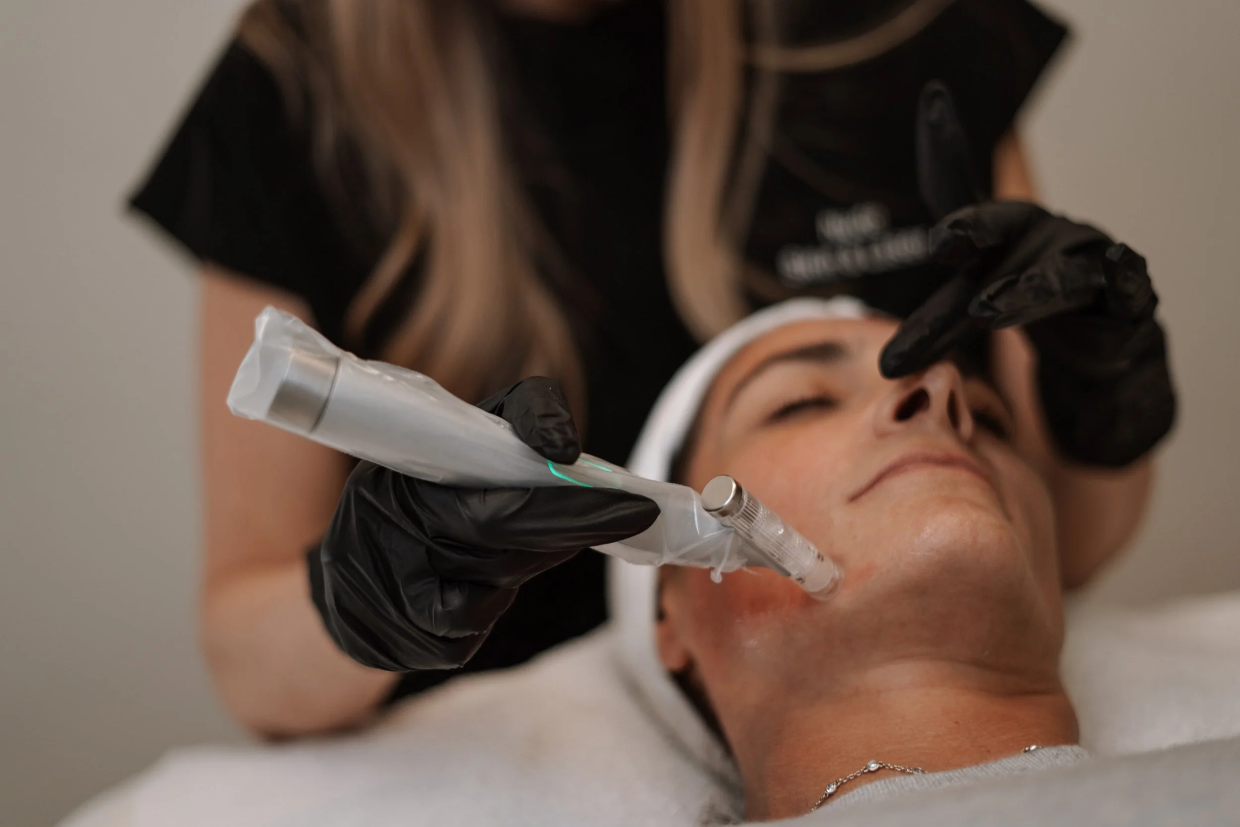 Client receiving EvoPen microneedling treatment at Nude Skin & Laser in Langley, BC to stimulate collagen and improve skin texture.