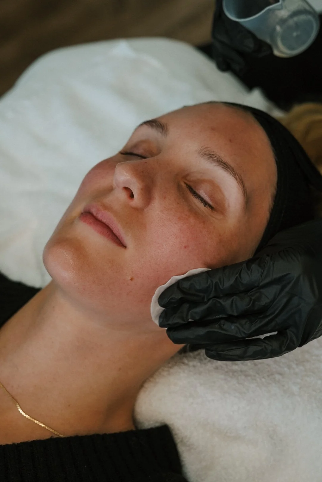 Client having her skin cleansed and prepared before a ZO Stimulator Peel at Nude Skin & Laser in Langley, BC.