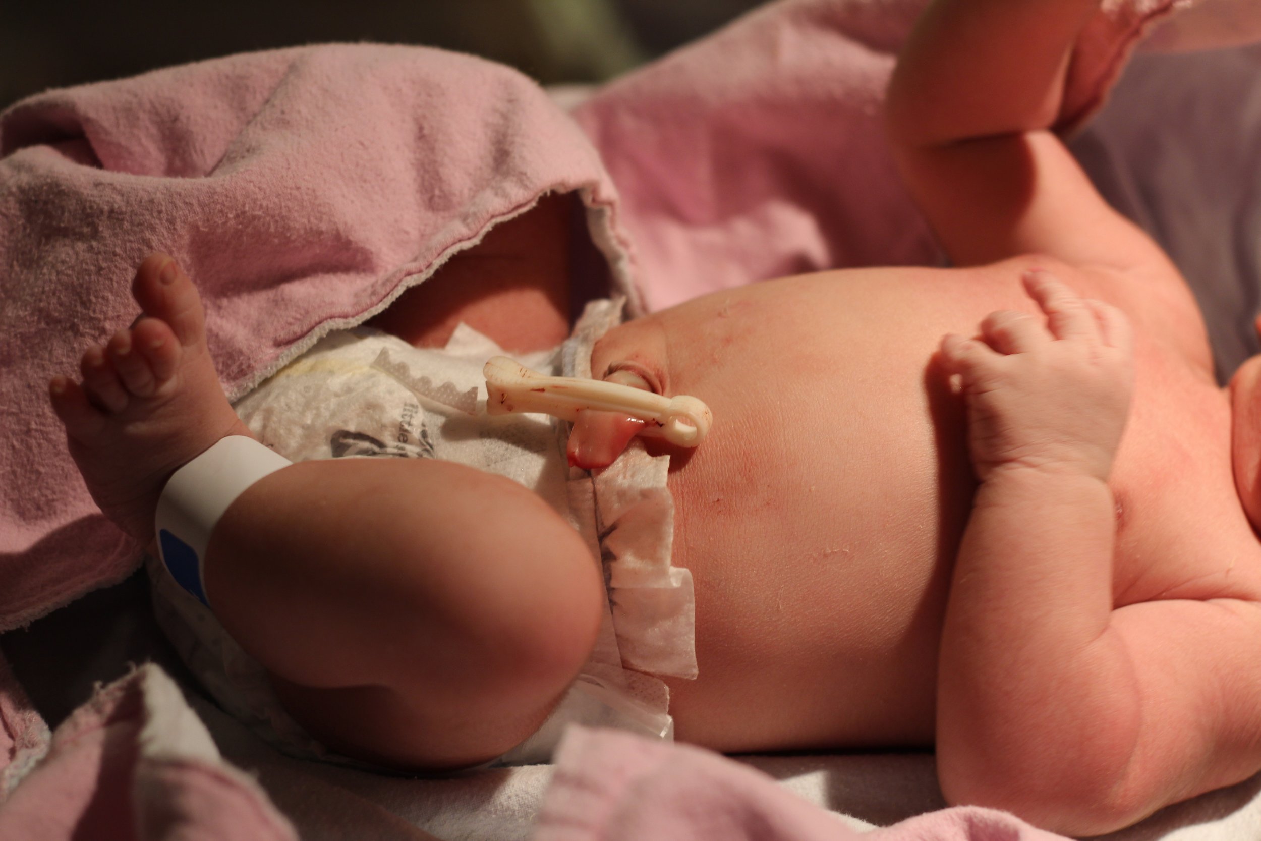 Delayed Cord Clamping Risks and Benefits at RVH and Collingwood General and Marine Hospital