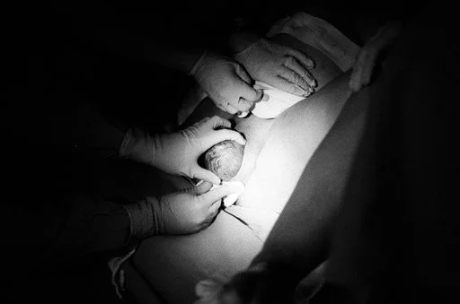 Collingwood Birth Photography Packages