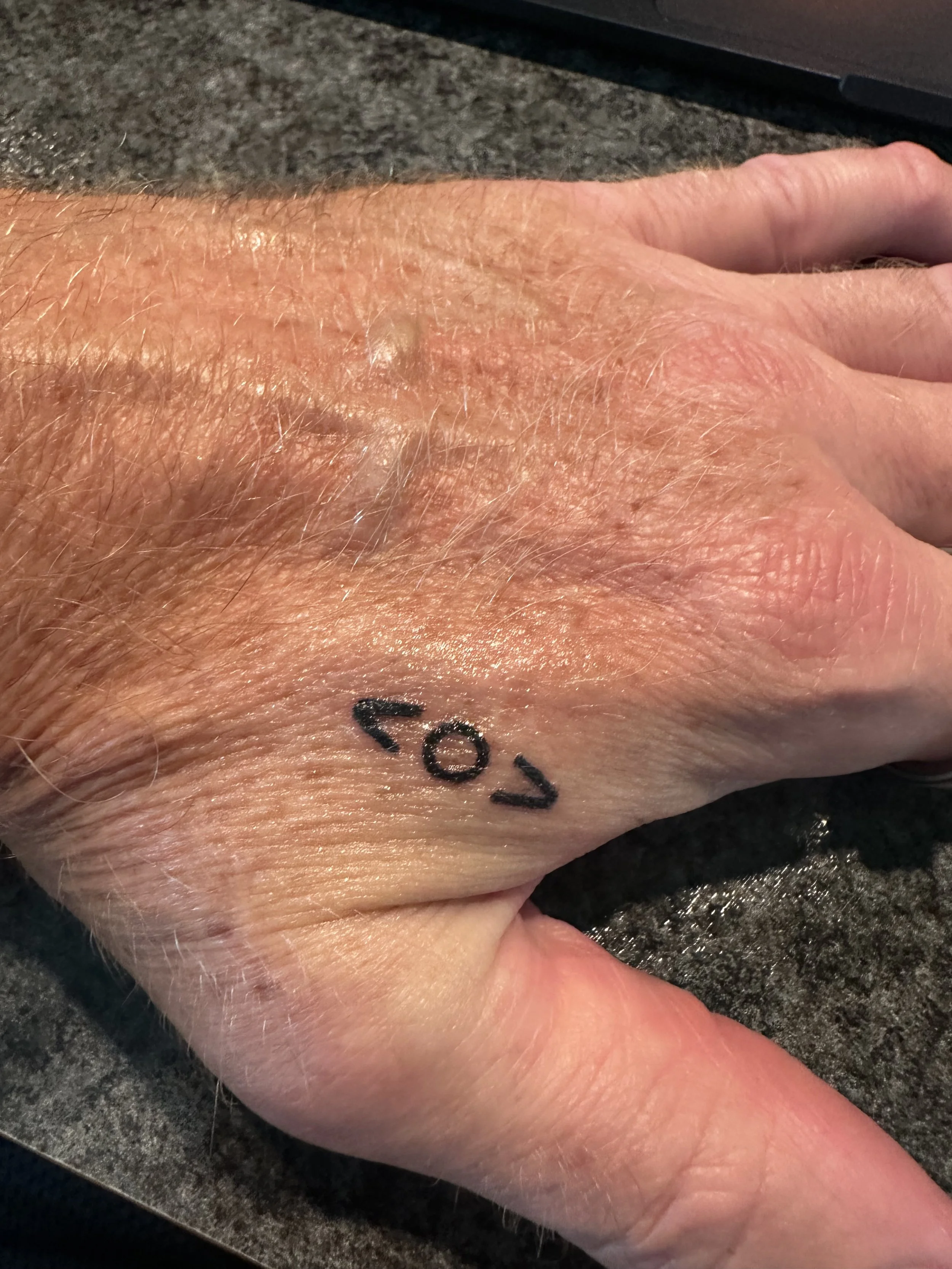 The Seal of Rambaldi tattoo.