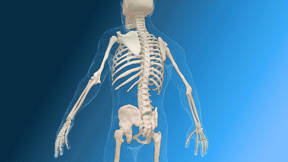 Skelett mit teilweise sichtbarem menschlichem Körper im Hintergrund.