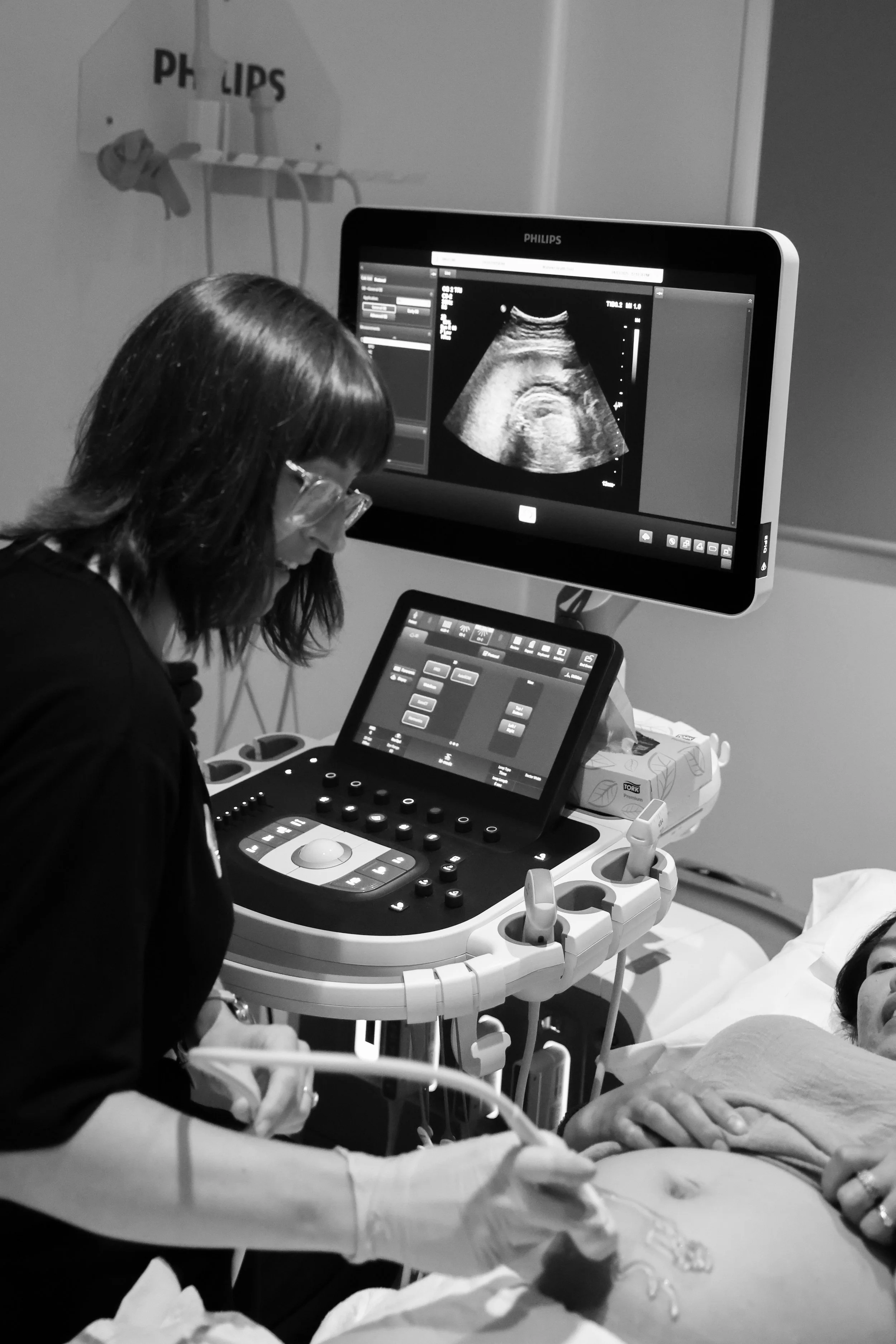 Ultrasound machine on Waiheke Island performing a prenatal ultrasound (baby scan).
