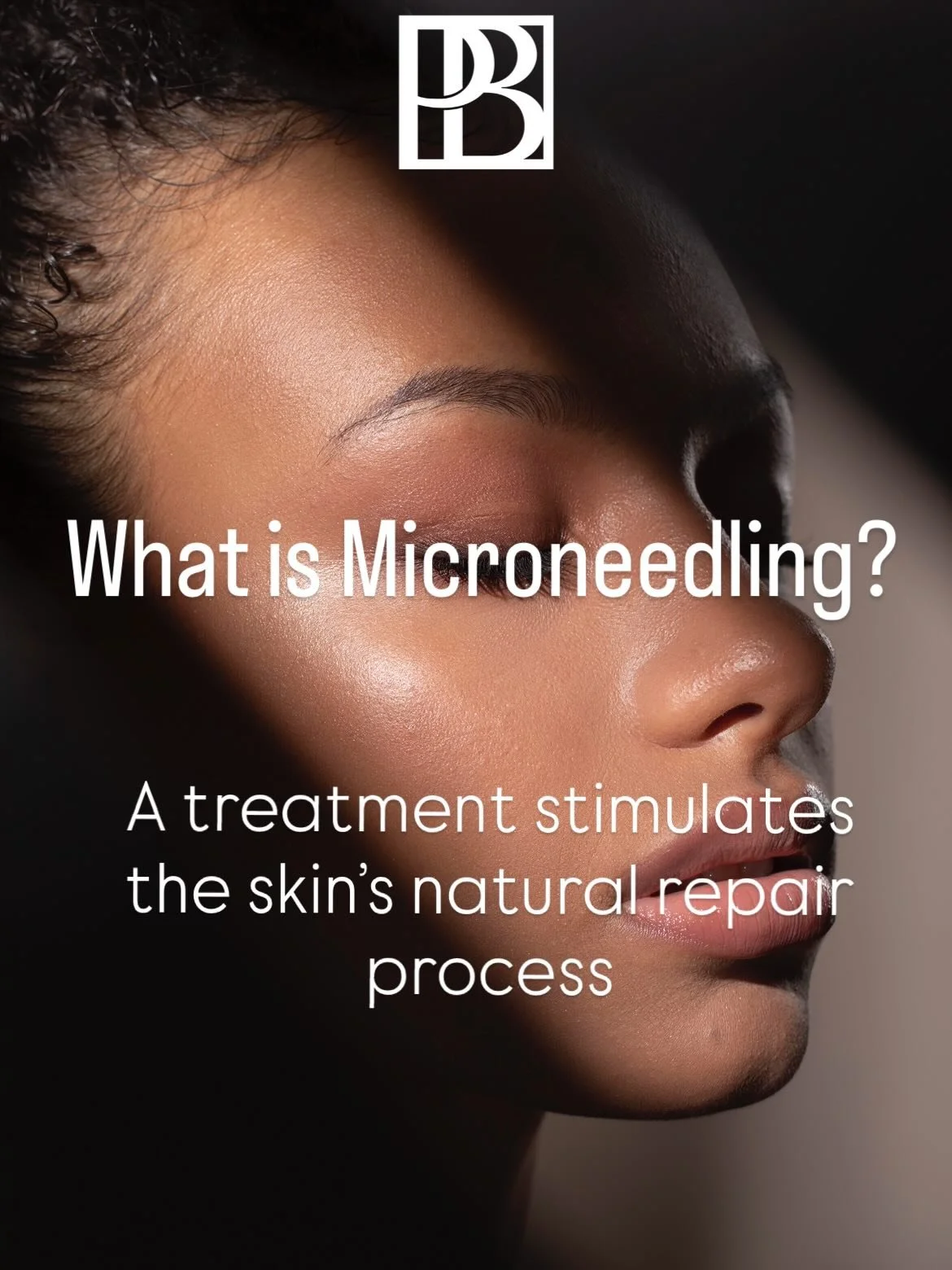 Microneedling works with the skin&rsquo;s natural healing process.

It&rsquo;s not about instant results, it&rsquo;s about stimulating collagen safely and progressively.

If you&rsquo;d like to understand whether microneedling is suitable for your sk