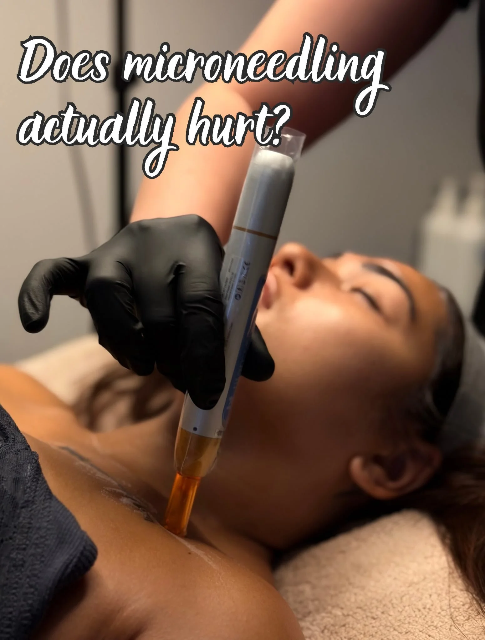 The big question&hellip; does microneedling actually hurt? 👀

It&rsquo;s one of the most common concerns before booking, but you might be surprised by the answer!

Swipe to find out what the treatment actually feels like 🤍