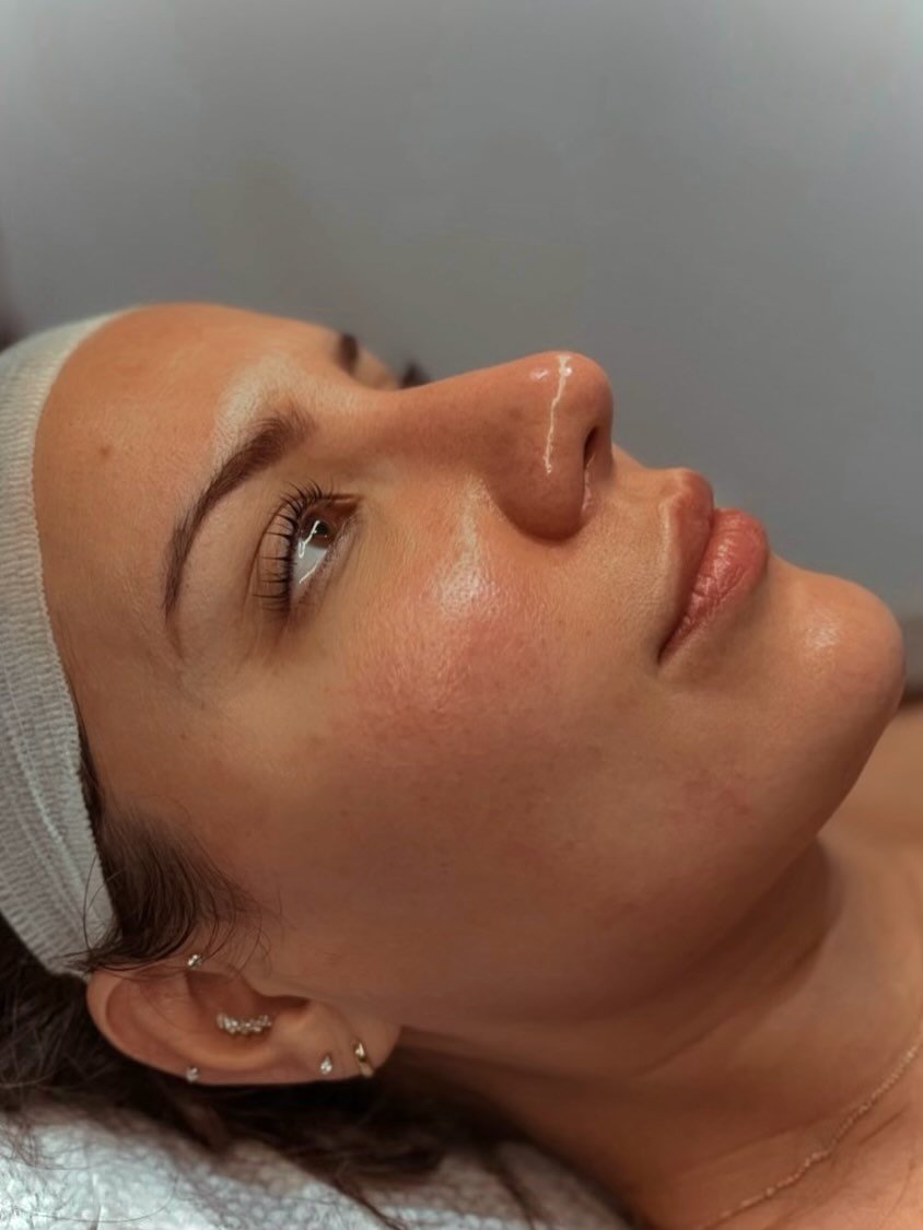 Still waiting for your skin to improve on its own?

No need to guess, as a skin specialist, we know exactly how to analyse your needs and treatments for REAL results. 
Your skincare routine can only do so much. Professional facials help target conges
