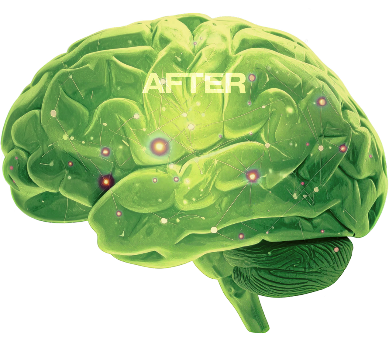 A digitally edited green brain with neural connections overlaid, featuring the word 'AFTER' written across it.