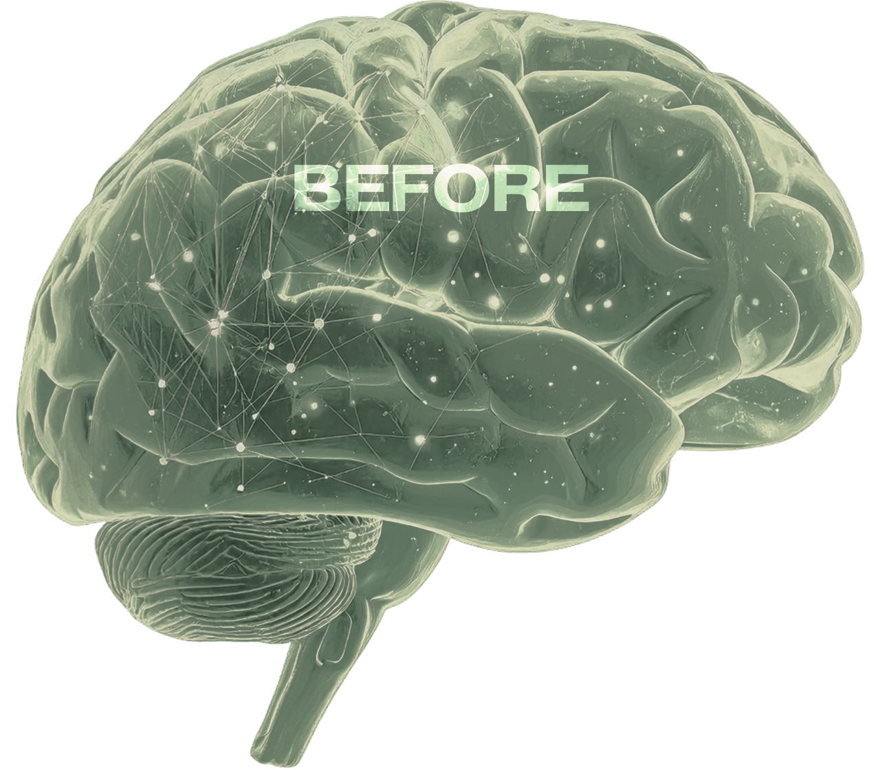 Digital illustration of a human brain with interconnected neural network lines, with the word 'BEFORE' overlaid.