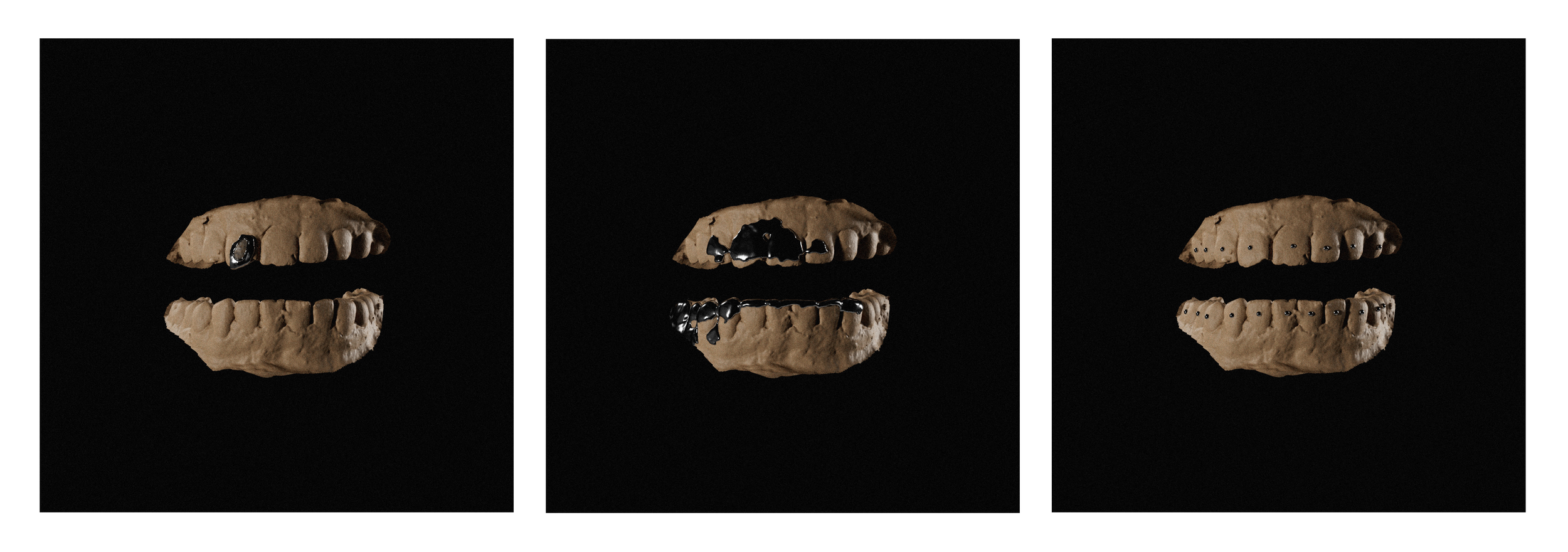 ReflectiveTeething.png