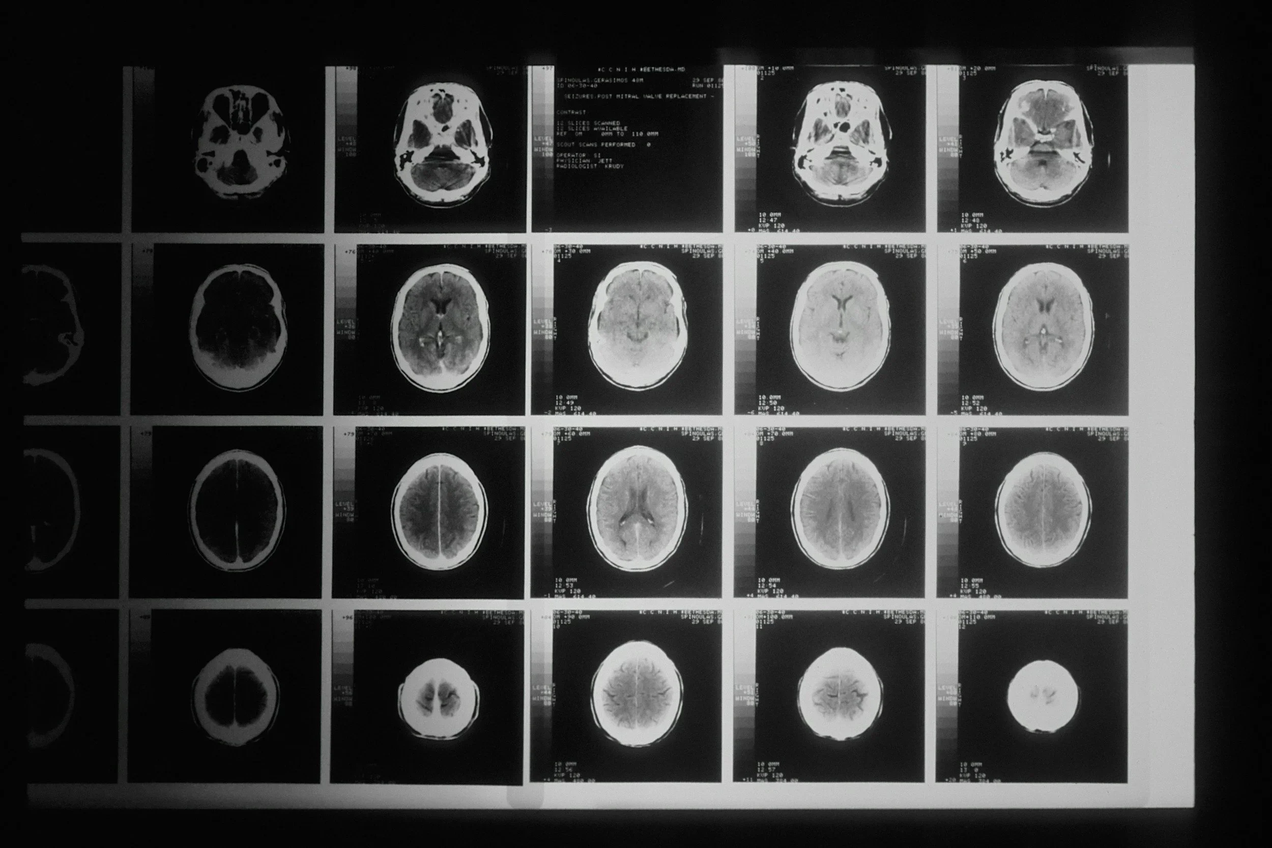 A grid of medical brain scans illustrating the neurobiological effects of trauma on brain structure and function, discussed by Pennsylvania trauma therapist Mariah J. Zur.