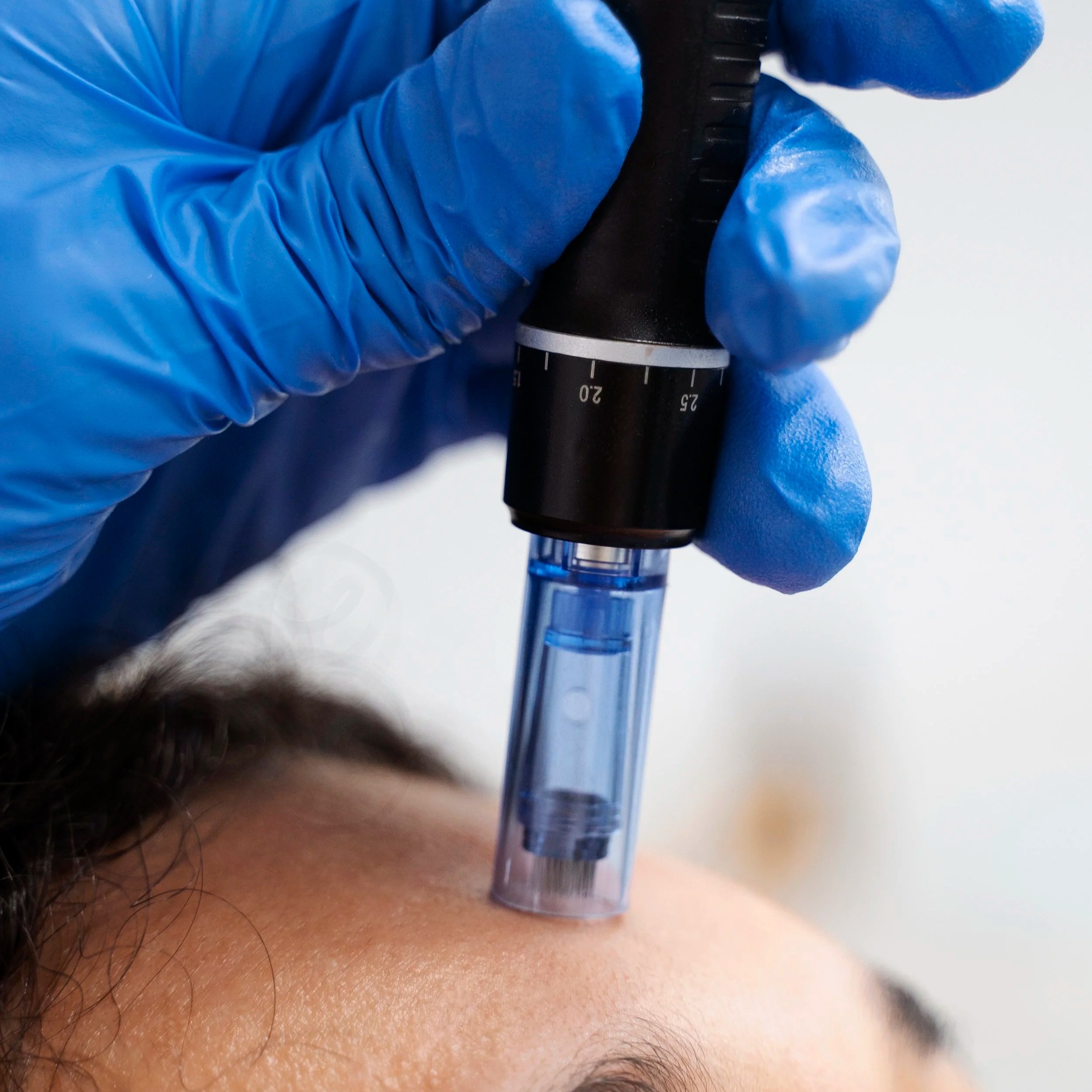 med spa microneedling injectables medical aesthetics