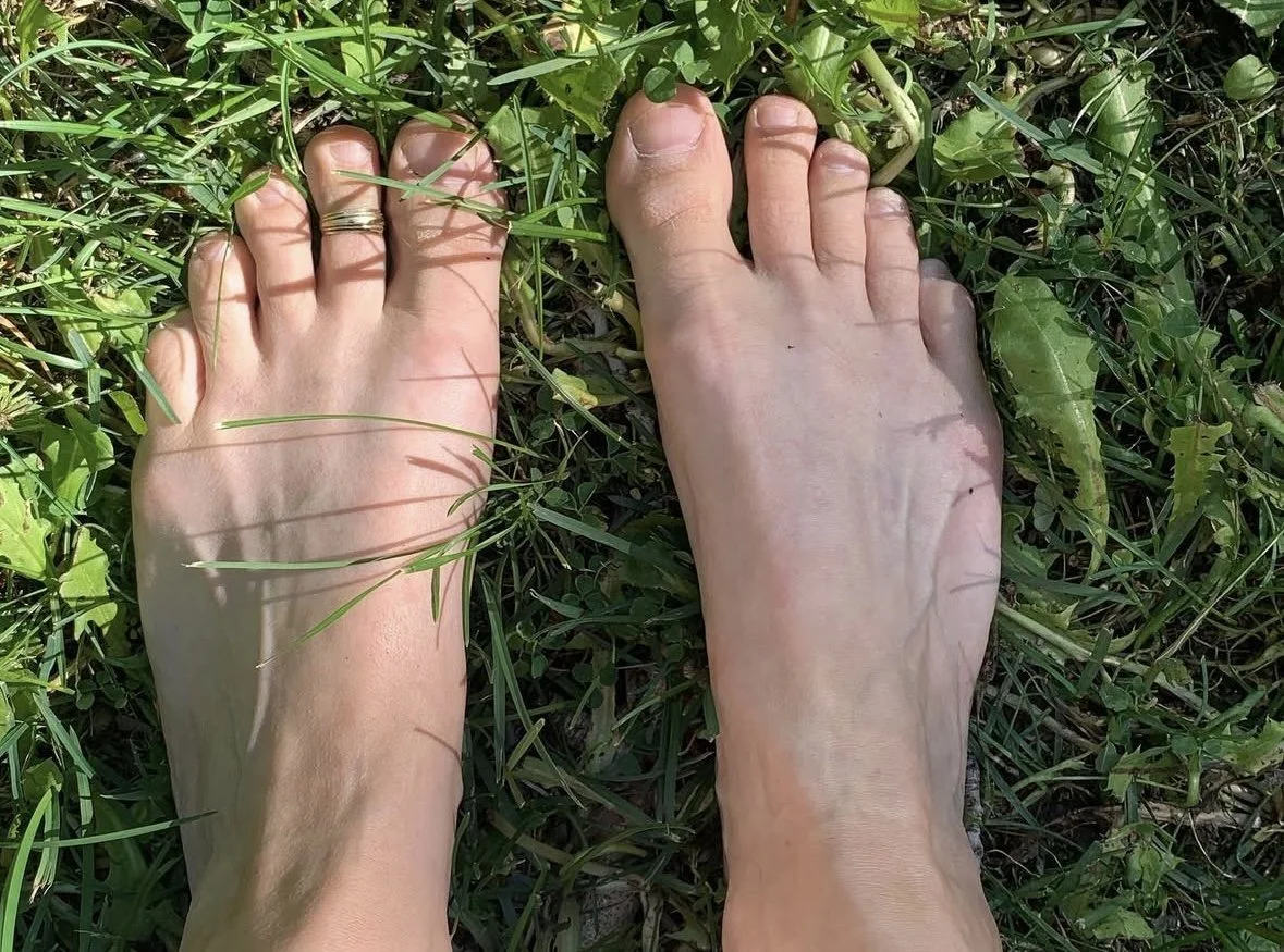 Ayurveda and Migraine