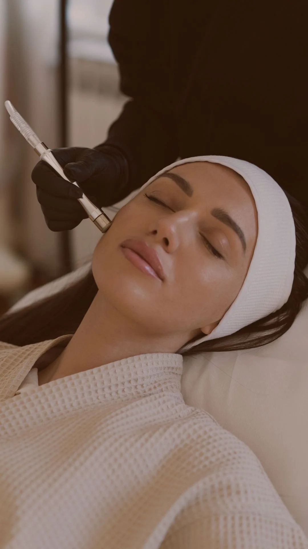 Skin Lab Microneedling with PDRN