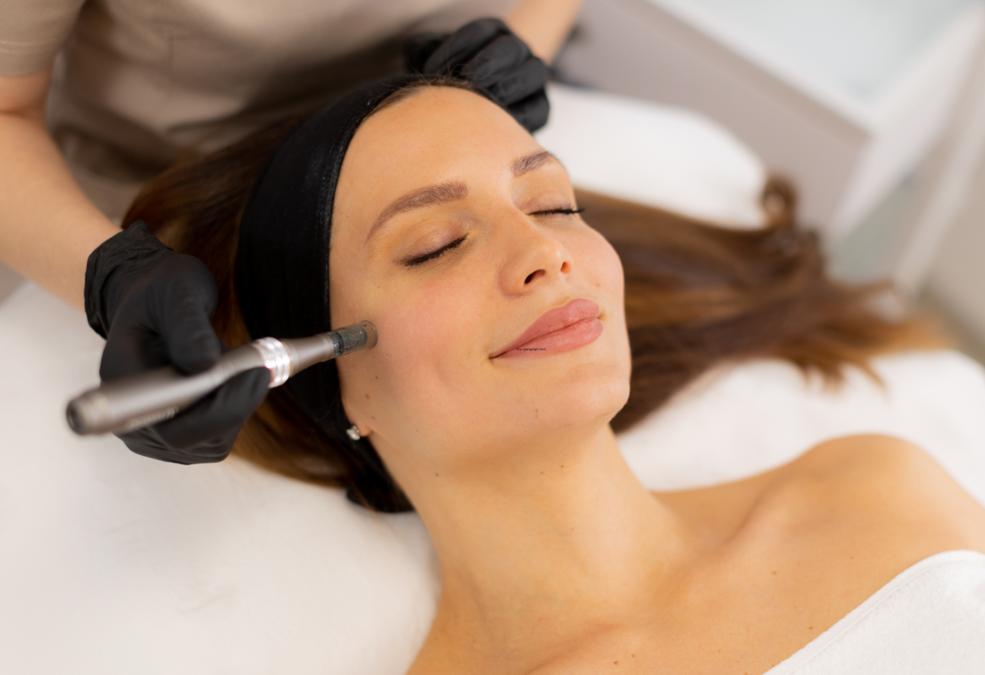 Skin Lab Microneedling  with poly-L-lactic acid