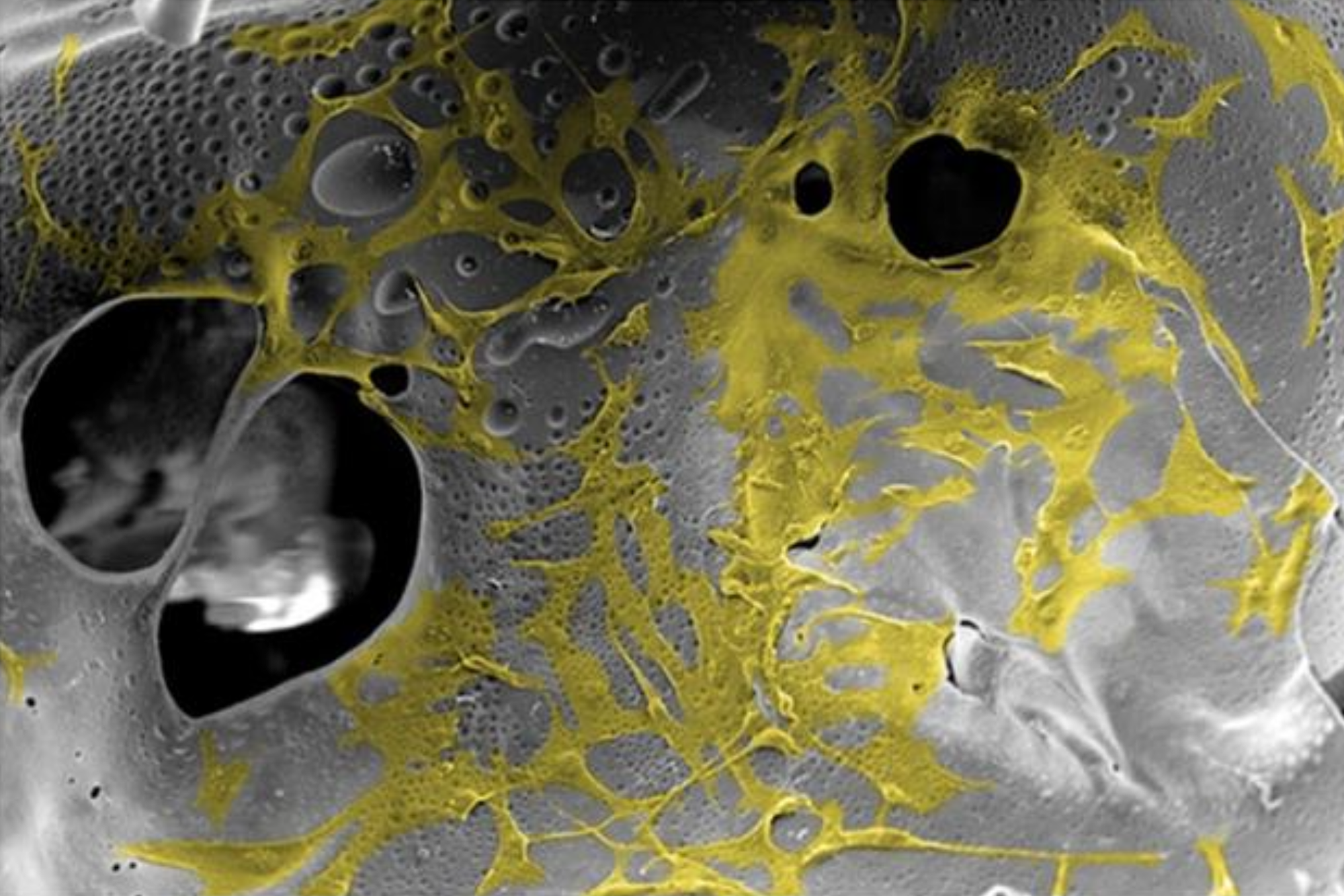 Natalie’s work on degradable and bioactive shape memory polymer foams is published in JBMRA!