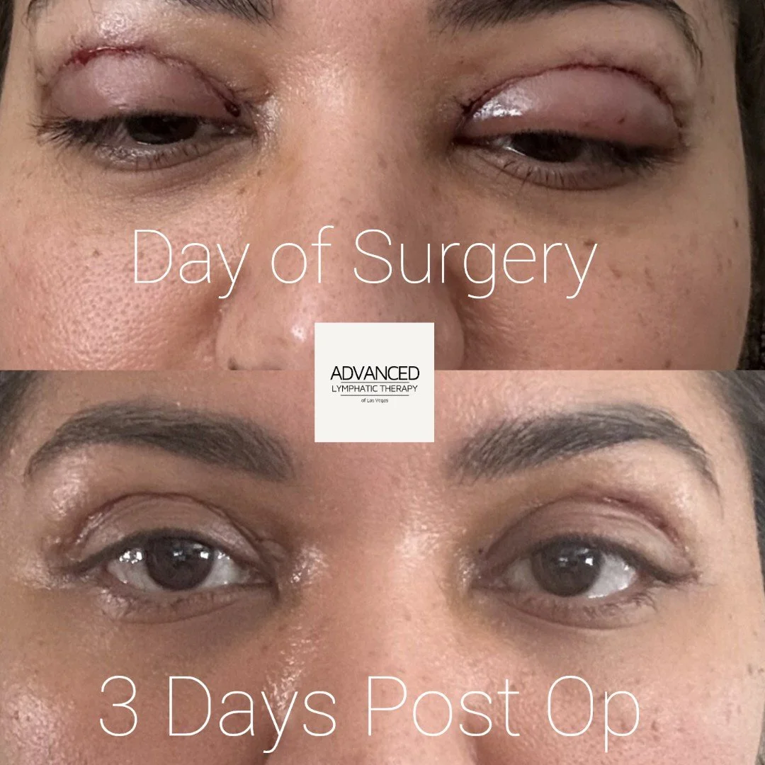 lymphatic massage in las vegas