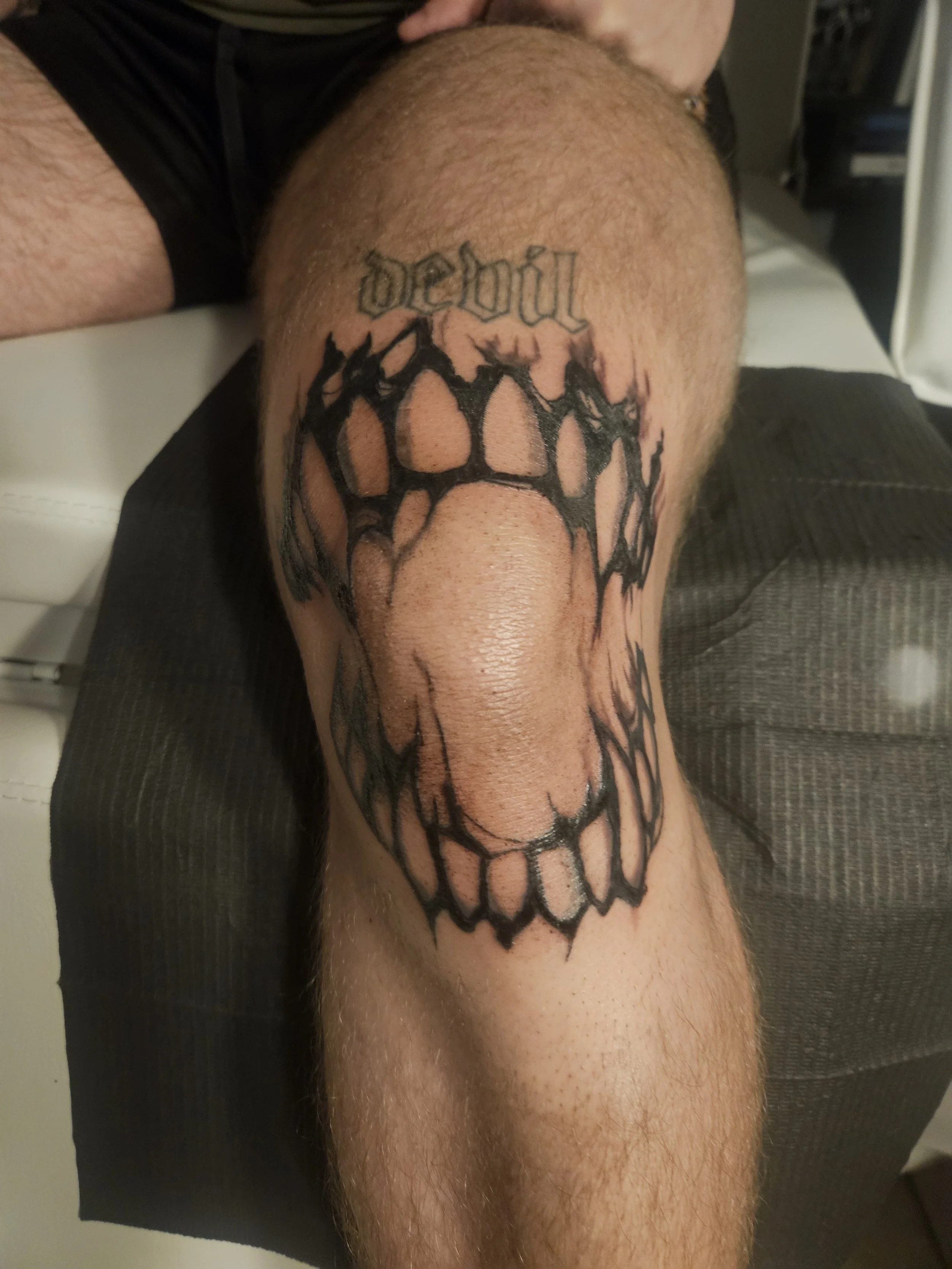 Jaw around knee