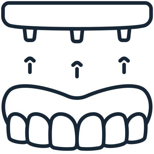 Illustration of a dental implant procedure with a dental bridge and surrounding teeth.