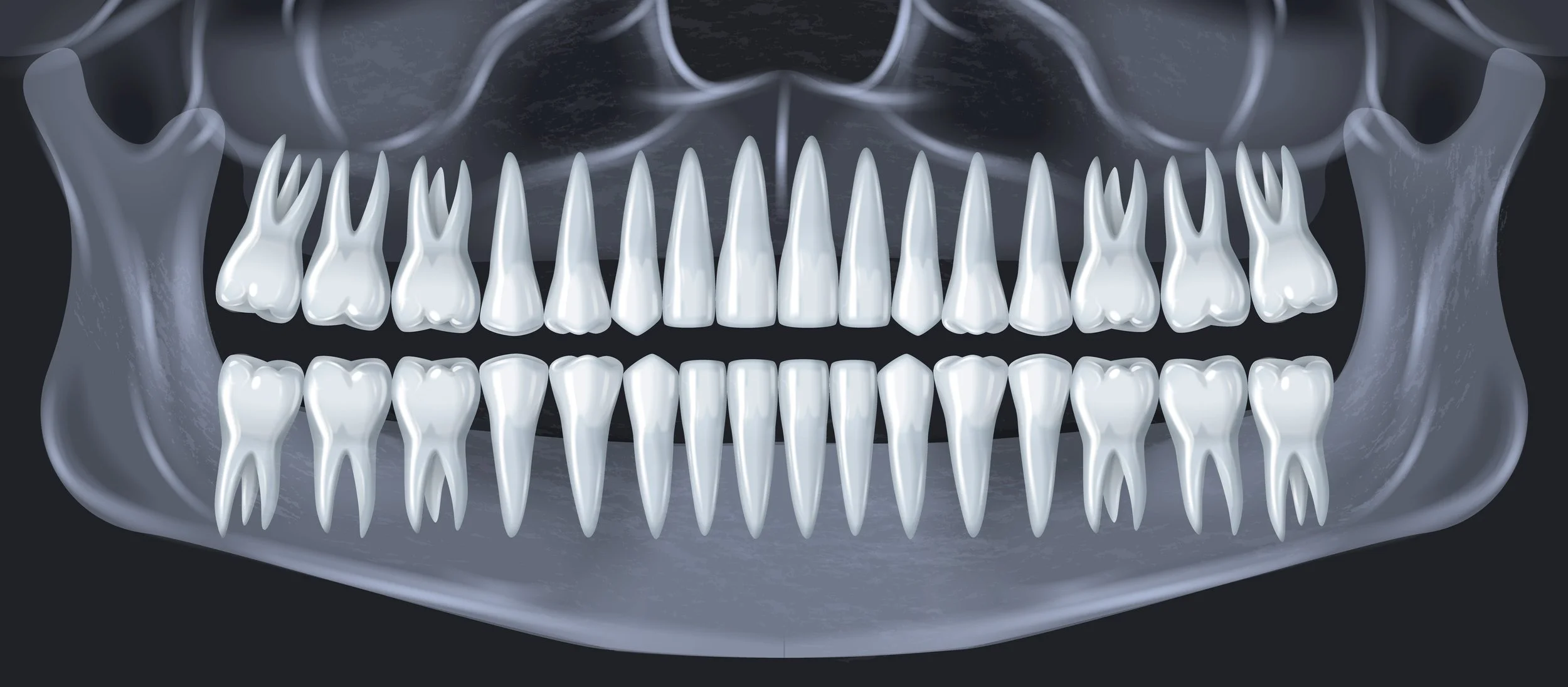 X-ray image of a human skull showing upper and lower teeth with multiple sharp, pointed teeth.