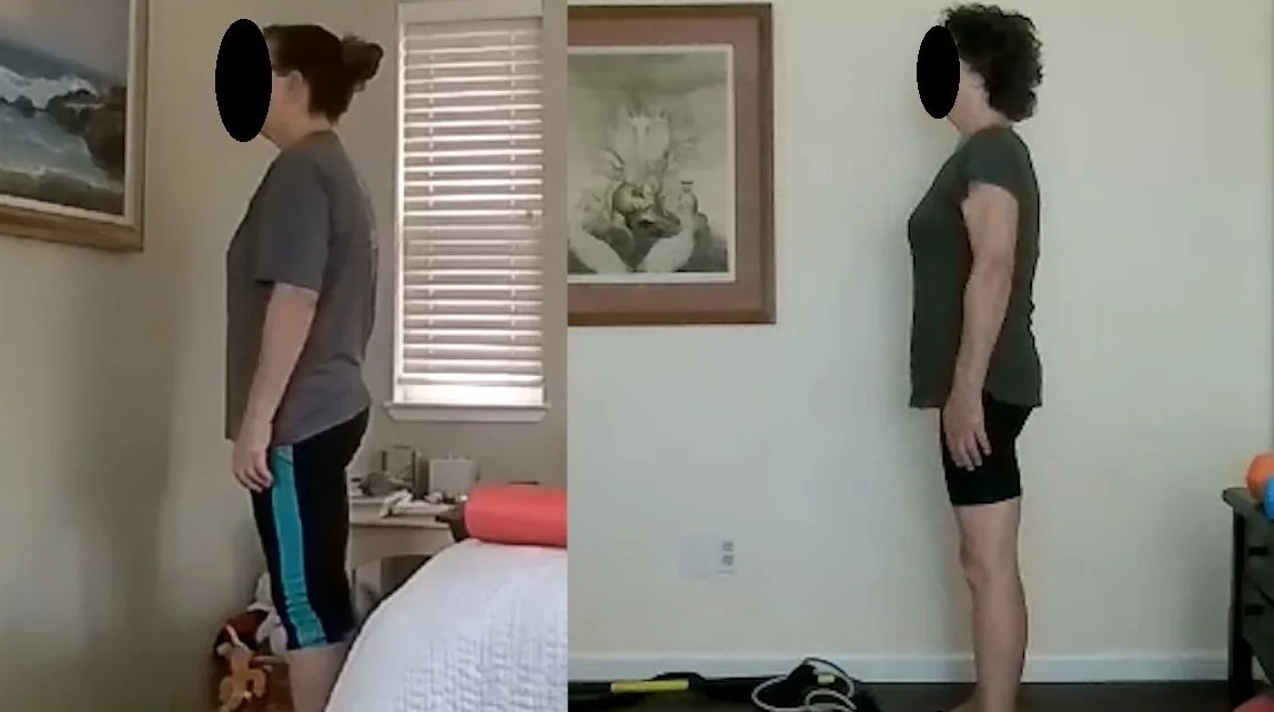 LM Fit6 - Before and After - posture improvement.jpg