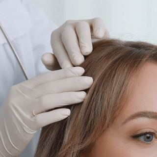 Close-up of a person receiving a scalp injection from a healthcare professional wearing gloves.