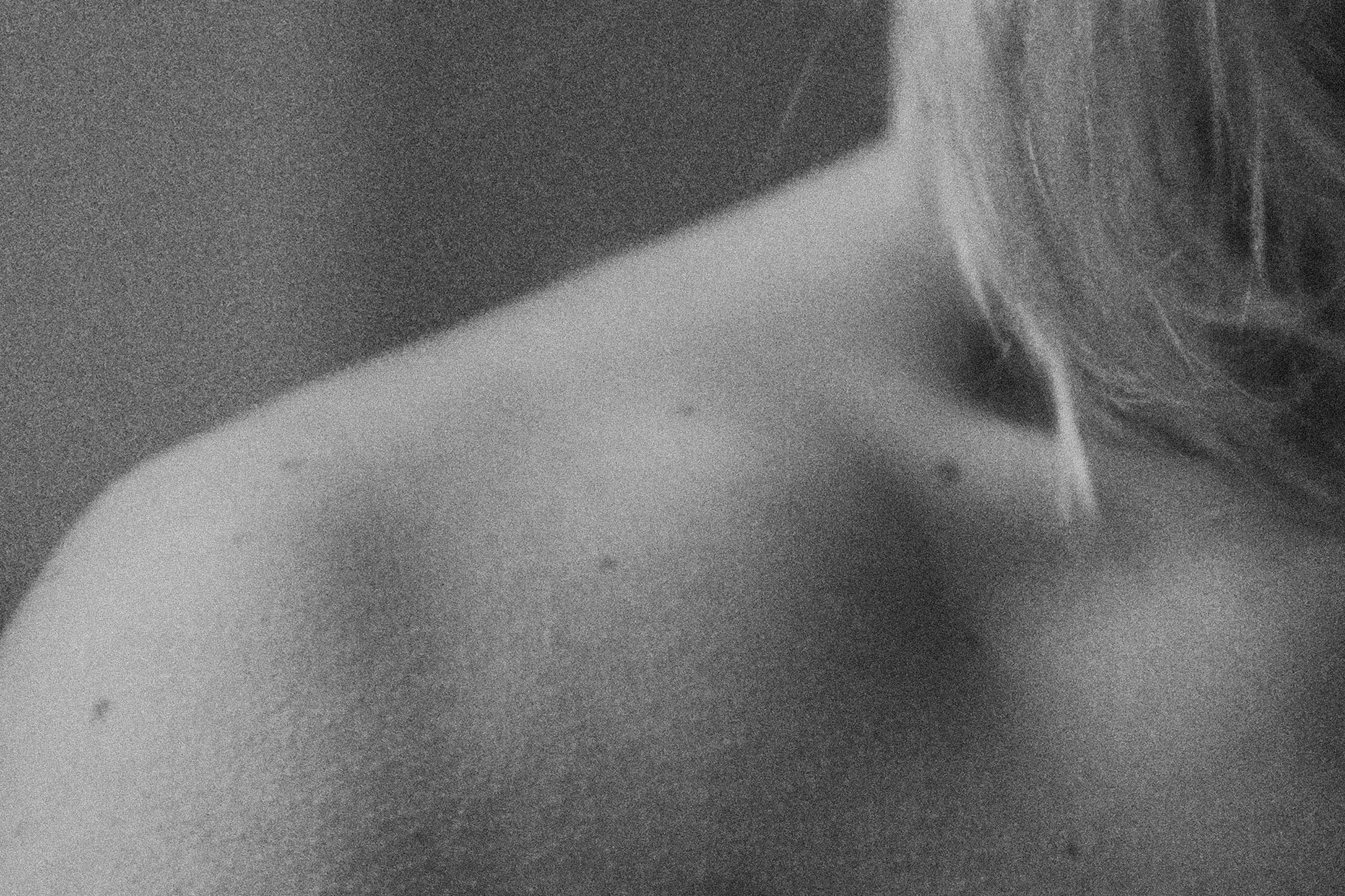 Why Mole Mapping Matters: A Simple Habit That Could Make a Big Difference