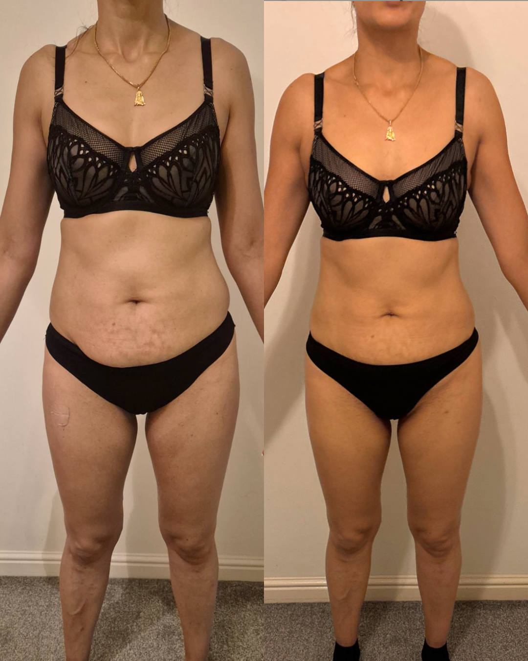 A before-and-after comparison of a woman showing significant body transformation. In both images, she wears a black lace bra and black underwear. The left photo shows her with more body fat and cellulite, while the right photo shows a reduction in bo
