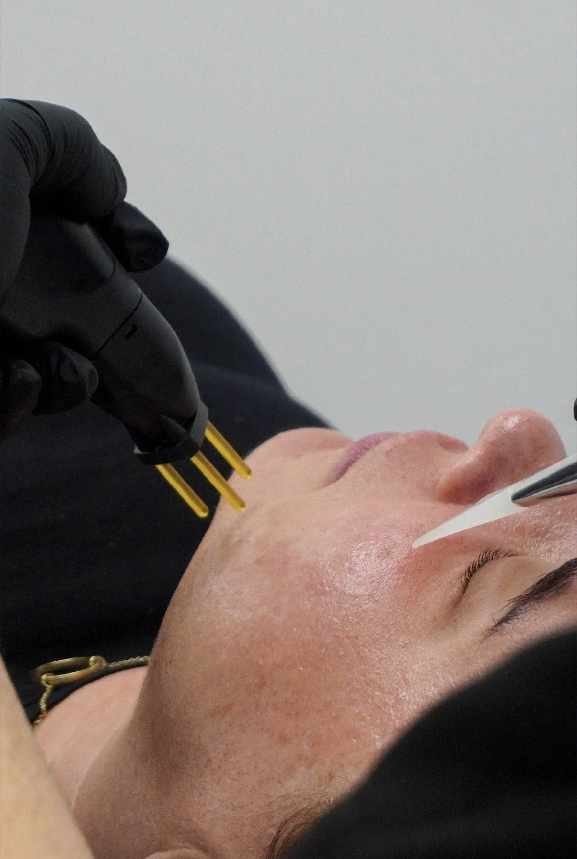 A person is undergoing a facial treatment, lying down with eyes closed, while a skincare professional uses a tool on their face.