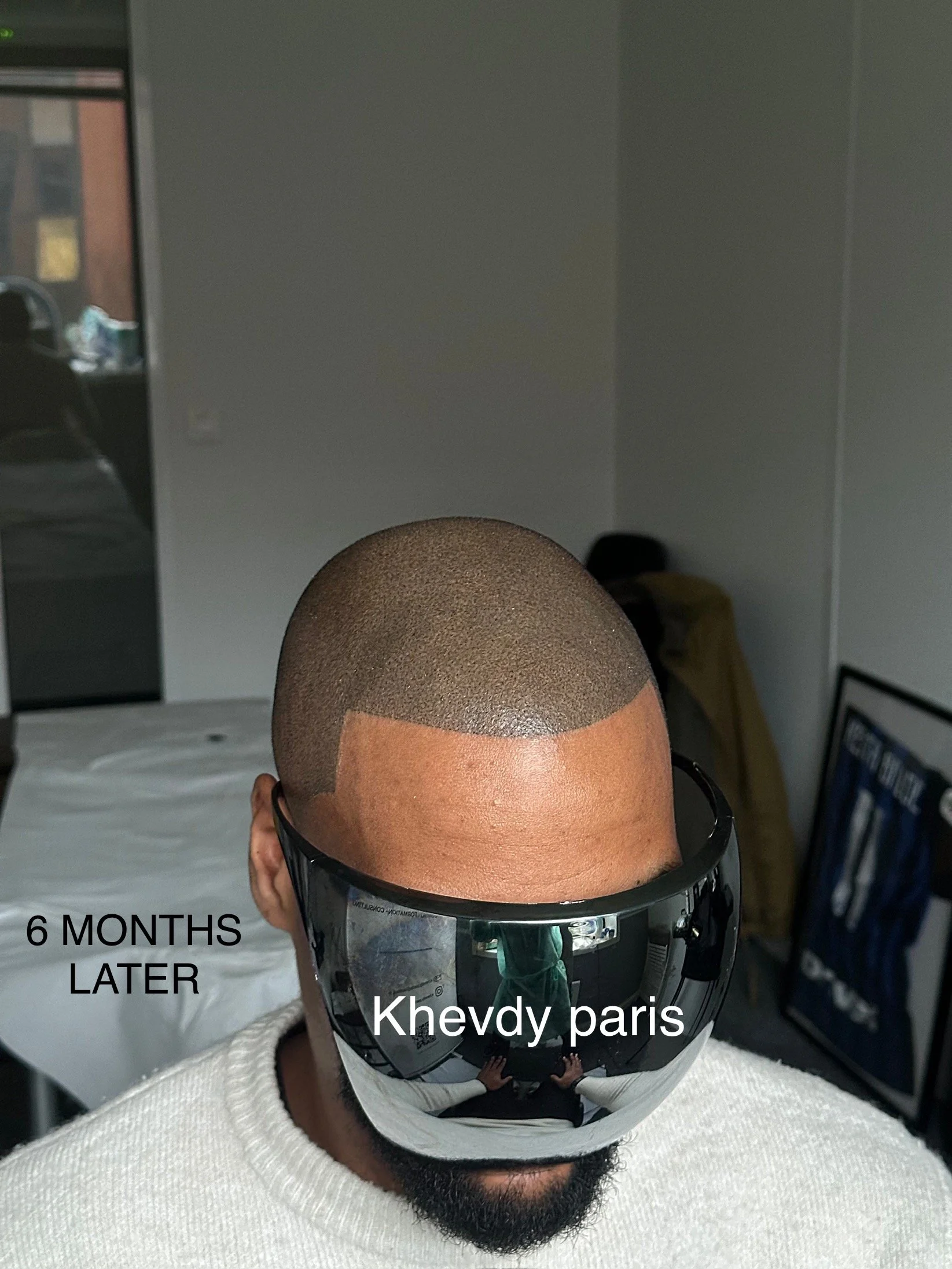 Un homme portant des lunettes de soleil réfléchissant une pièce, avec une marque indiquant 'Khevdy paris' sur son visage, et la légende '6 MONTHS LATER' à gauche.