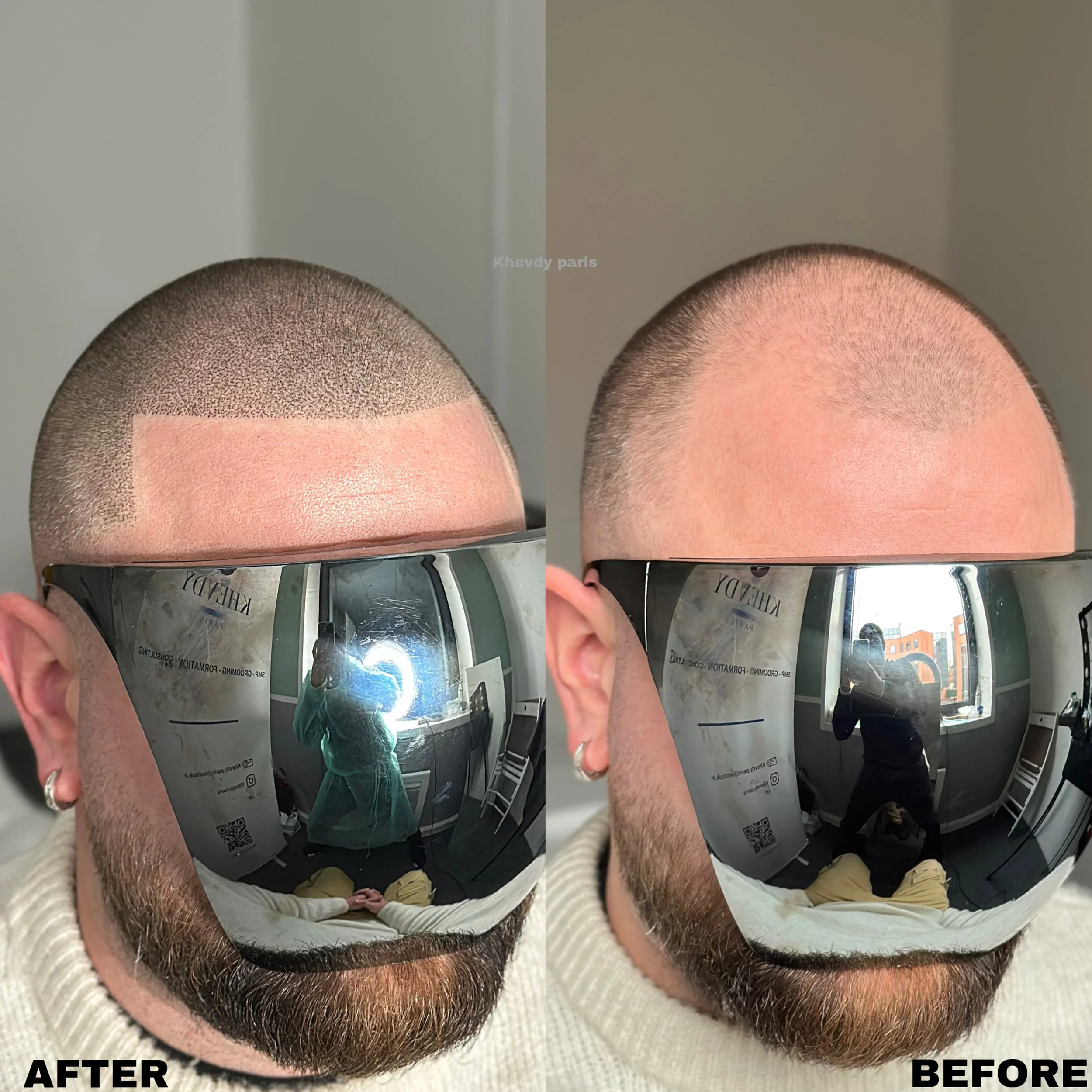 Avant et après une coupe de cheveux avec un style court et une teinture capillaire. Le client porte des lunettes de soleil réfléchissantes et a des boucles d'oreilles.