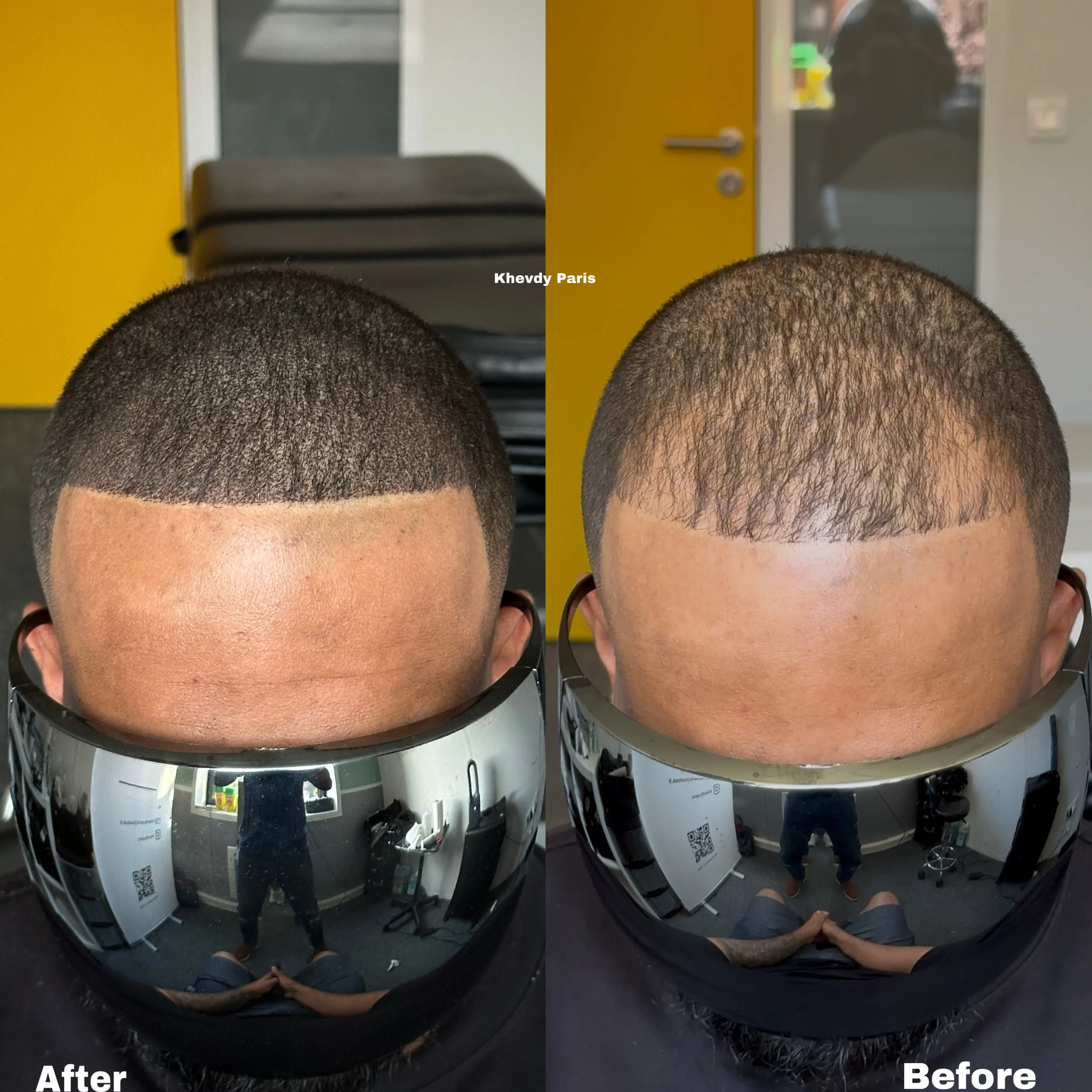 Image comparative montrant un homme avant et après une coupe de cheveux. La photo de gauche montre une coupe courte avec une ligne nette, tandis que celle de droite montre la même tête avec des cheveux plus longs et plus texturés. La reflection dans 