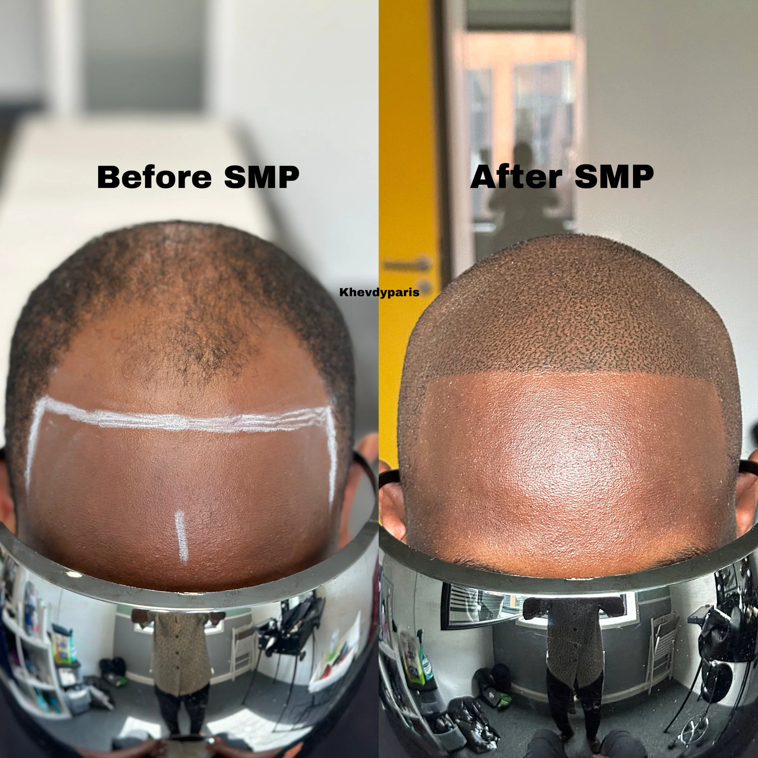 SMP avant/après effet rasé au style américain ! travail personnalisé pour notre client venu de loin pour faire à la qualité de notre service 