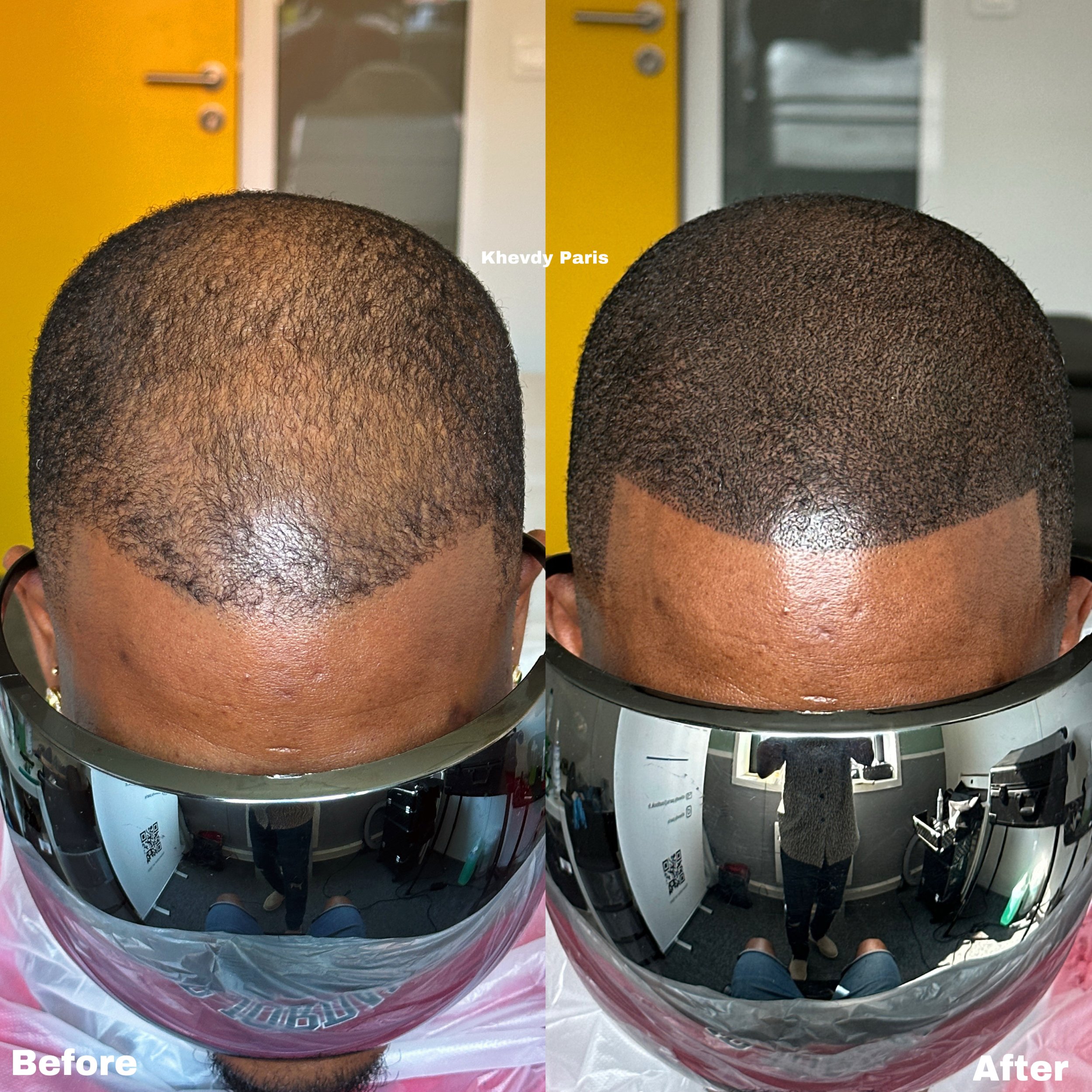 Transformation capillaire avant et après une coupe de cheveux et une nouvelle coiffure, visage vu du dessus, reflet dans le miroir
