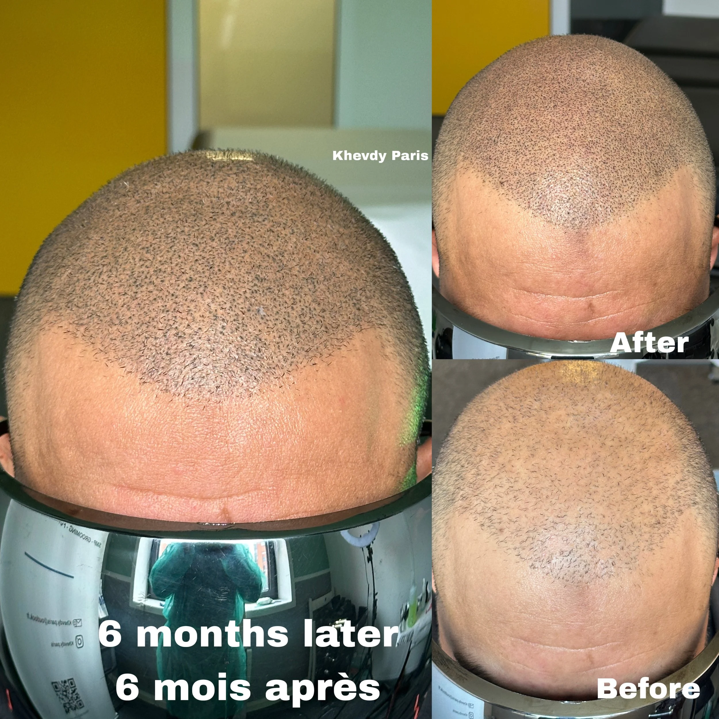 AC7441EA-2C3C-4BD3-8F4D-D3DB955824FD.JPEG