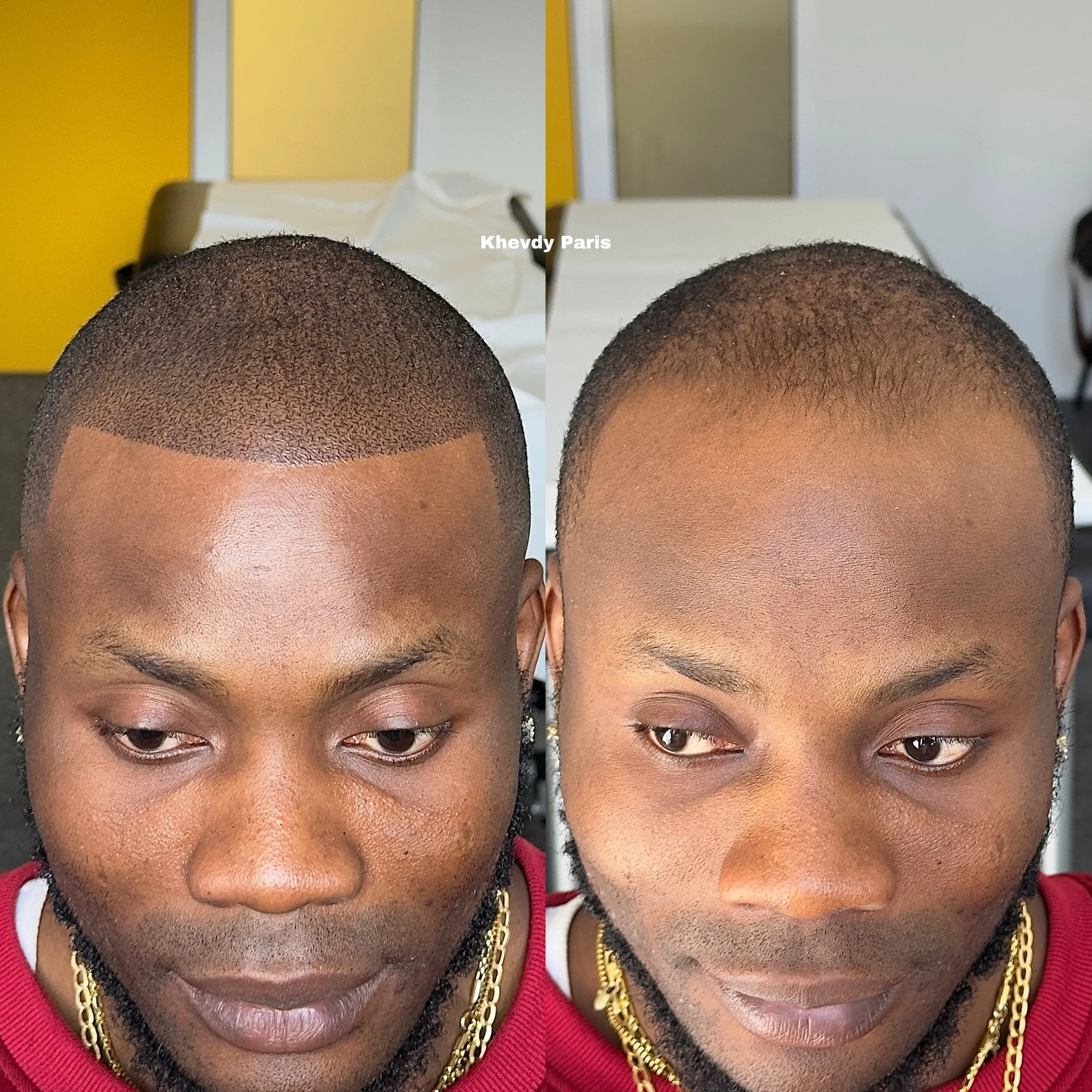 Contours : Restaurer vos contours sur mesure, finition naturelle. Redéfinition précise des contours avec une zone frontale bien tracée ou brute. Un travail minutieux pour un résultat 100 % personnalisé, parfaitement adapté à votre morphologie et à vo