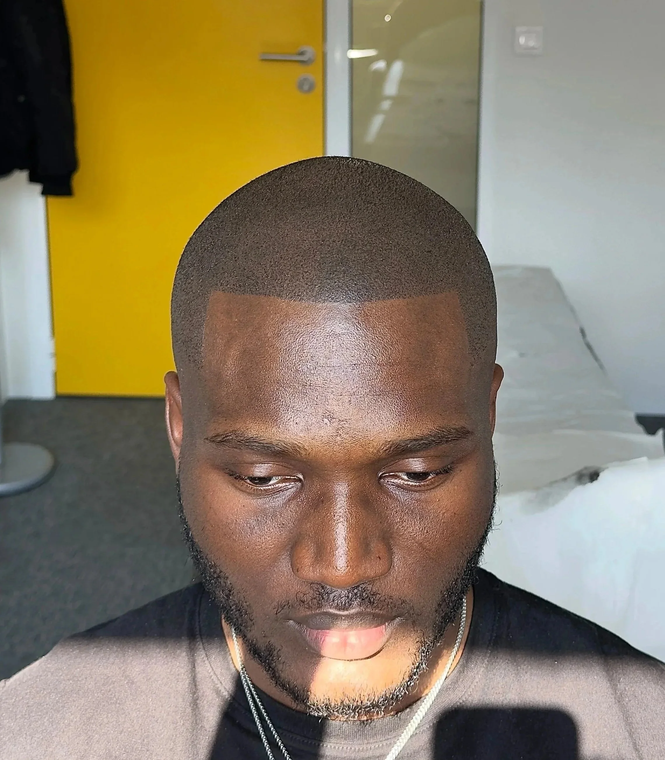 micropigmentation-capillaire-cicatrice-greffe.jpg micropigmentation-capillaire-cicatrice-cuir-chevelu-paris.jpg