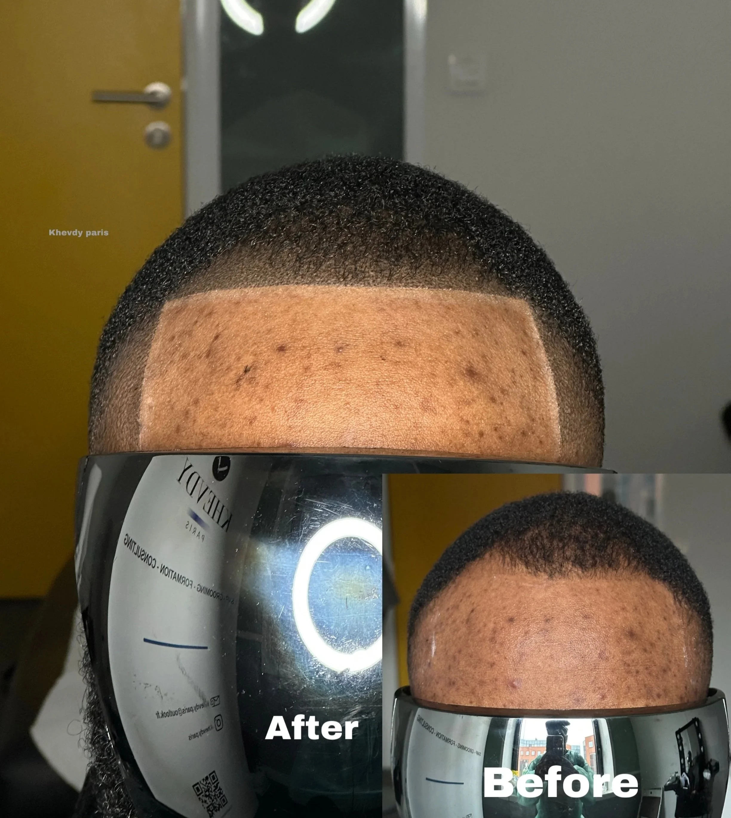 Contours : Restaurer vos contours sur mesure, finition naturelle. Redéfinition précise des contours avec une zone frontale bien tracée ou brute. Un travail minutieux pour un résultat 100 % personnalisé, parfaitement adapté à votre morphologie et à vo